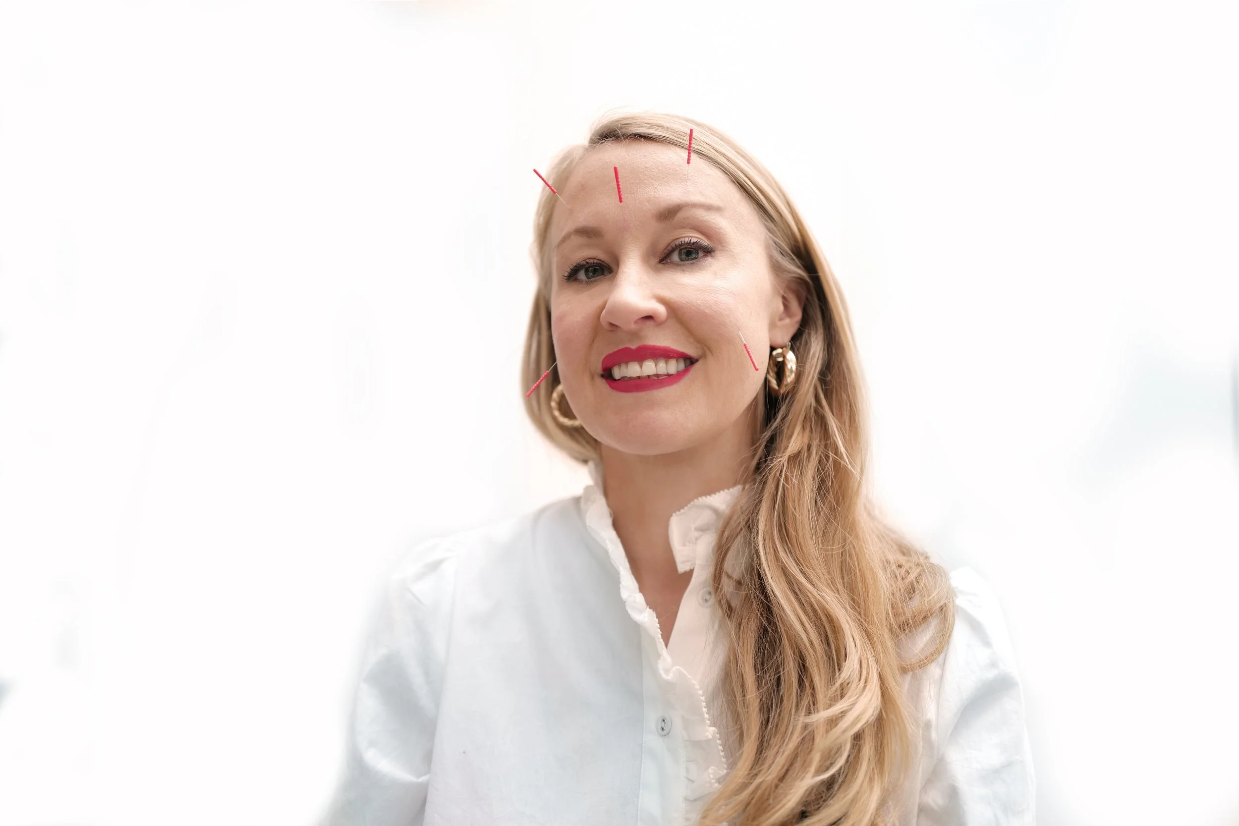 Facial acupuncture marylebone The French Pharmacy Cosmetic acupuncture