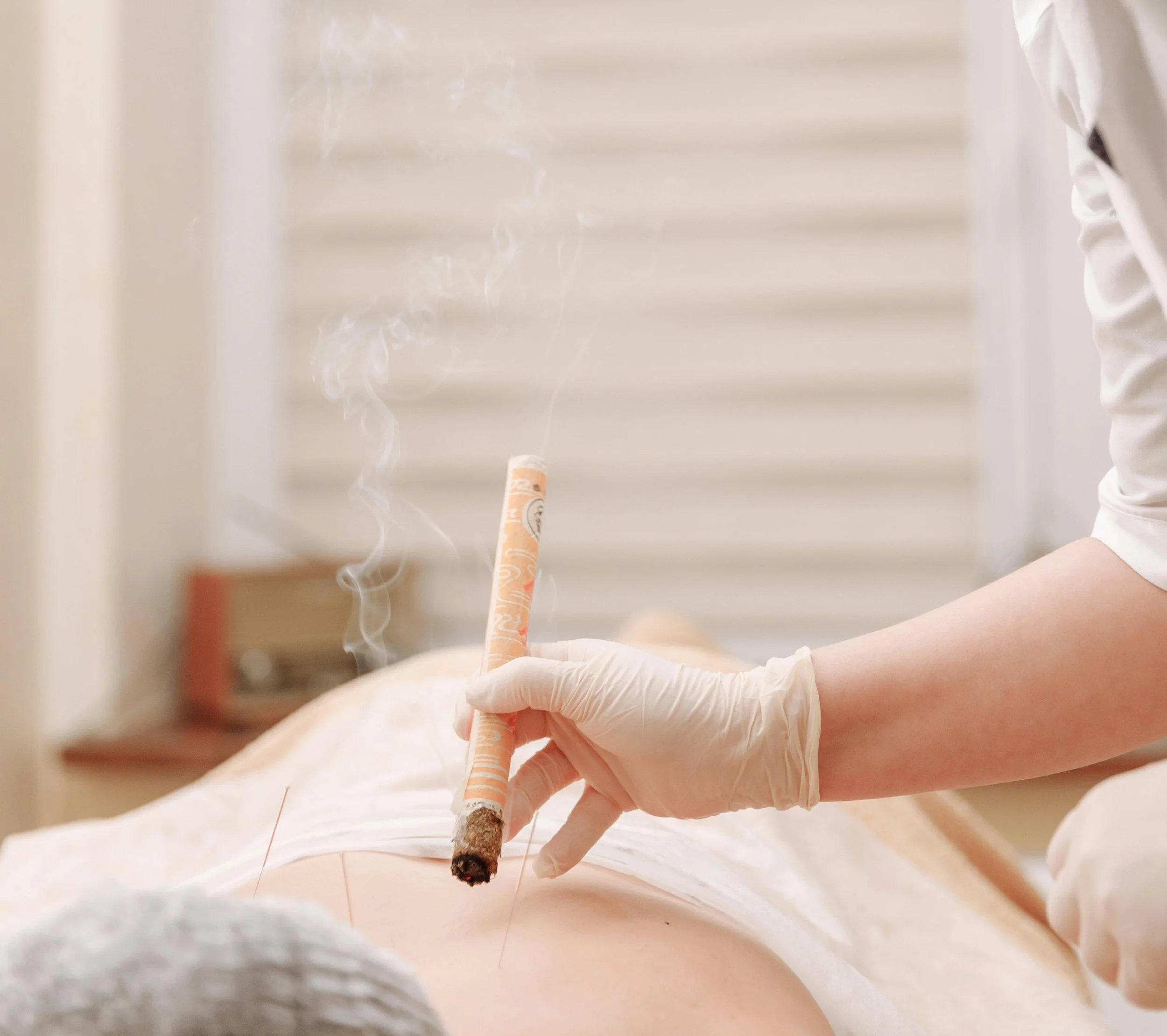 acupuncture tufnell park