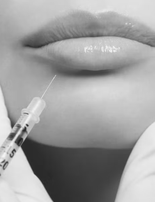 Close-up of lips with a syringe near the lower lip, suggesting a lip injection or cosmetic procedure.