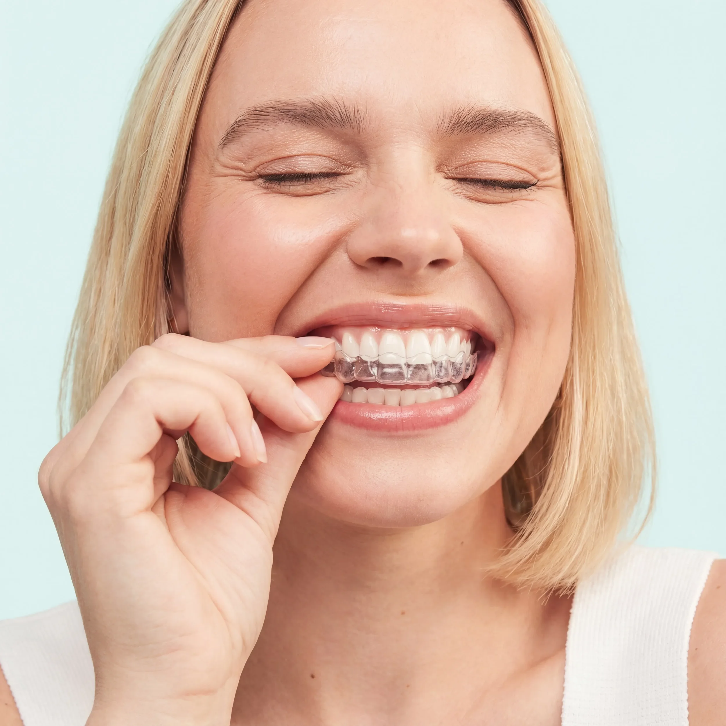 Close-up of a person inserting Invisalign clear aligners, illustrating the discreet and removable nature of the orthodontic treatment.
