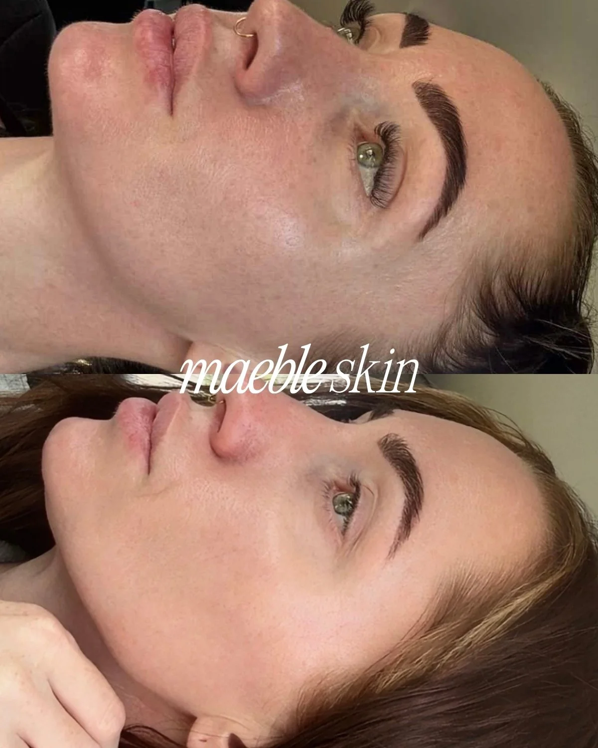 Before and after images of a woman's face showing a skin transformation, with the text 'maeble skin' overlaid.