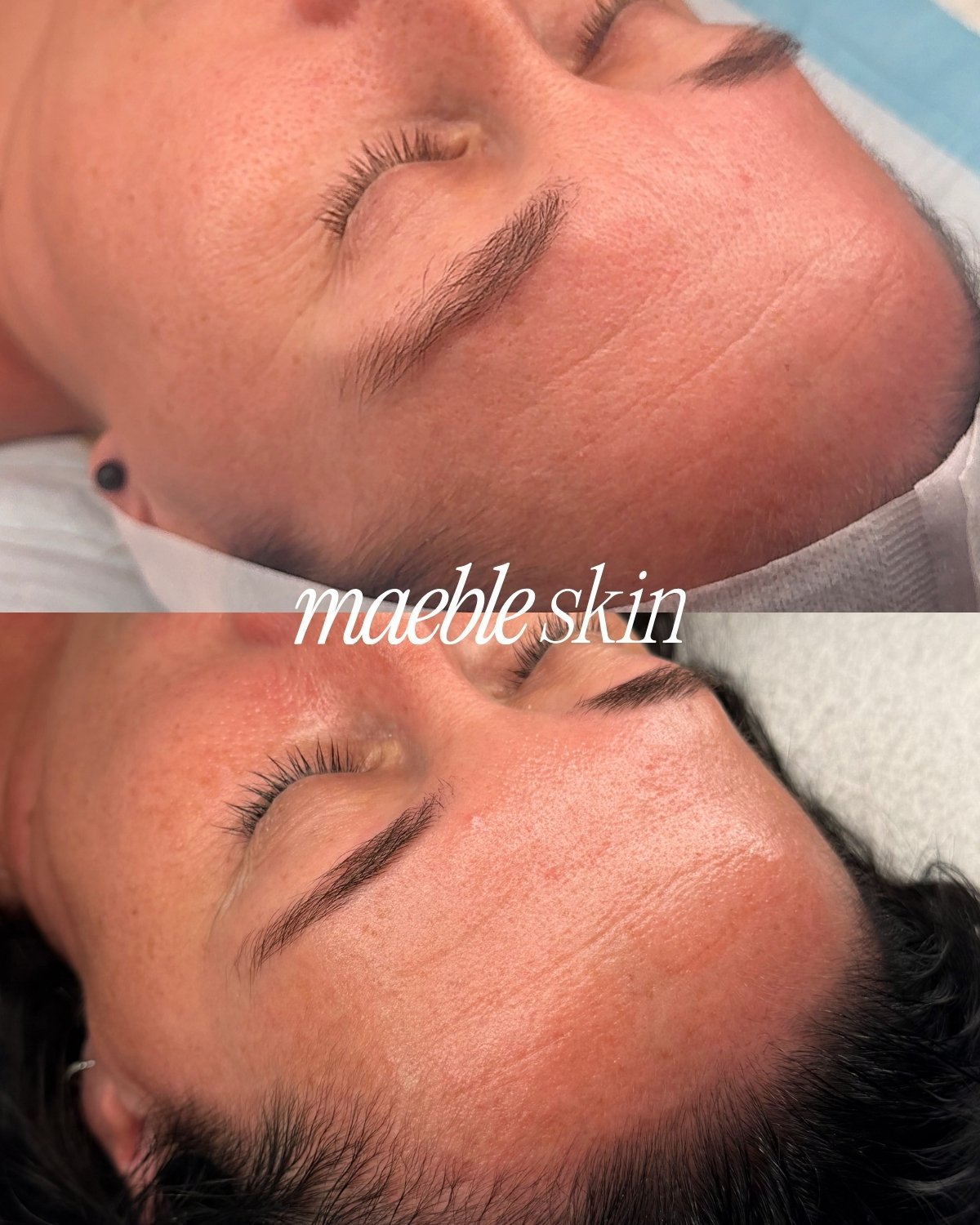 Close-up of two women lying down with their eyes closed, showing clear, smooth facial skin. The text 'maeble skin' is overlaid on the image.