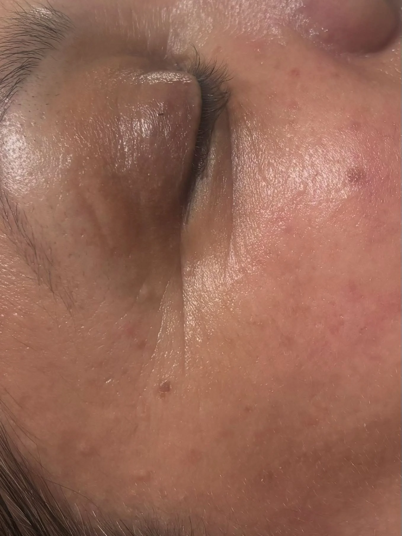 Swipe to see the glow up after 1 hour of our gorgeous facials. 

We offer medical grade facials for results! Book in your free skincare consultation to find out more

 #hbbhitchin #hbb #hairandbeauty #hairdresserhitchin #hairsalonhitchin #beautyhitch