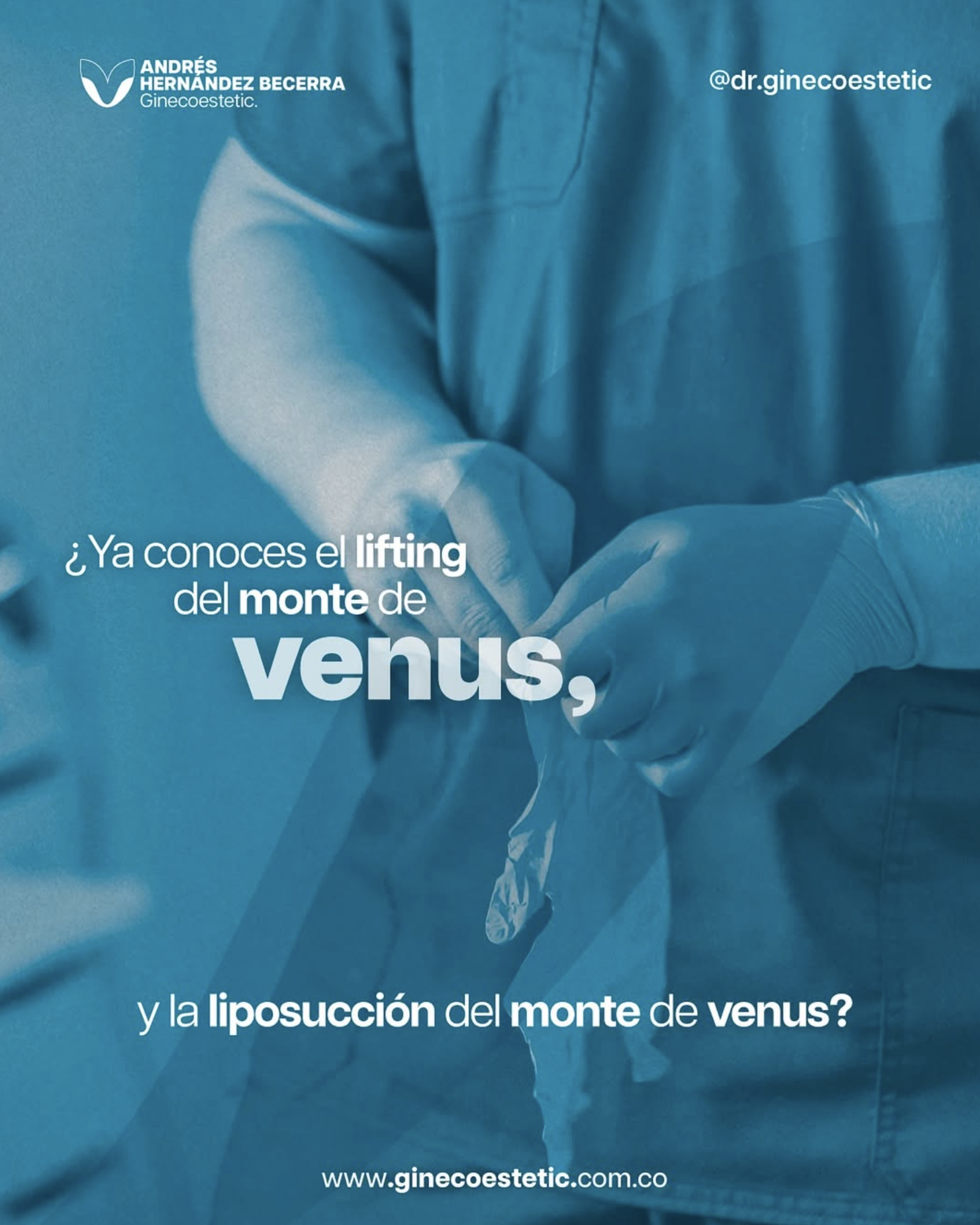 Liposucción del Monte de Venus en Cali: Solución para sentirte más cómoda al usar ropa ajustada.