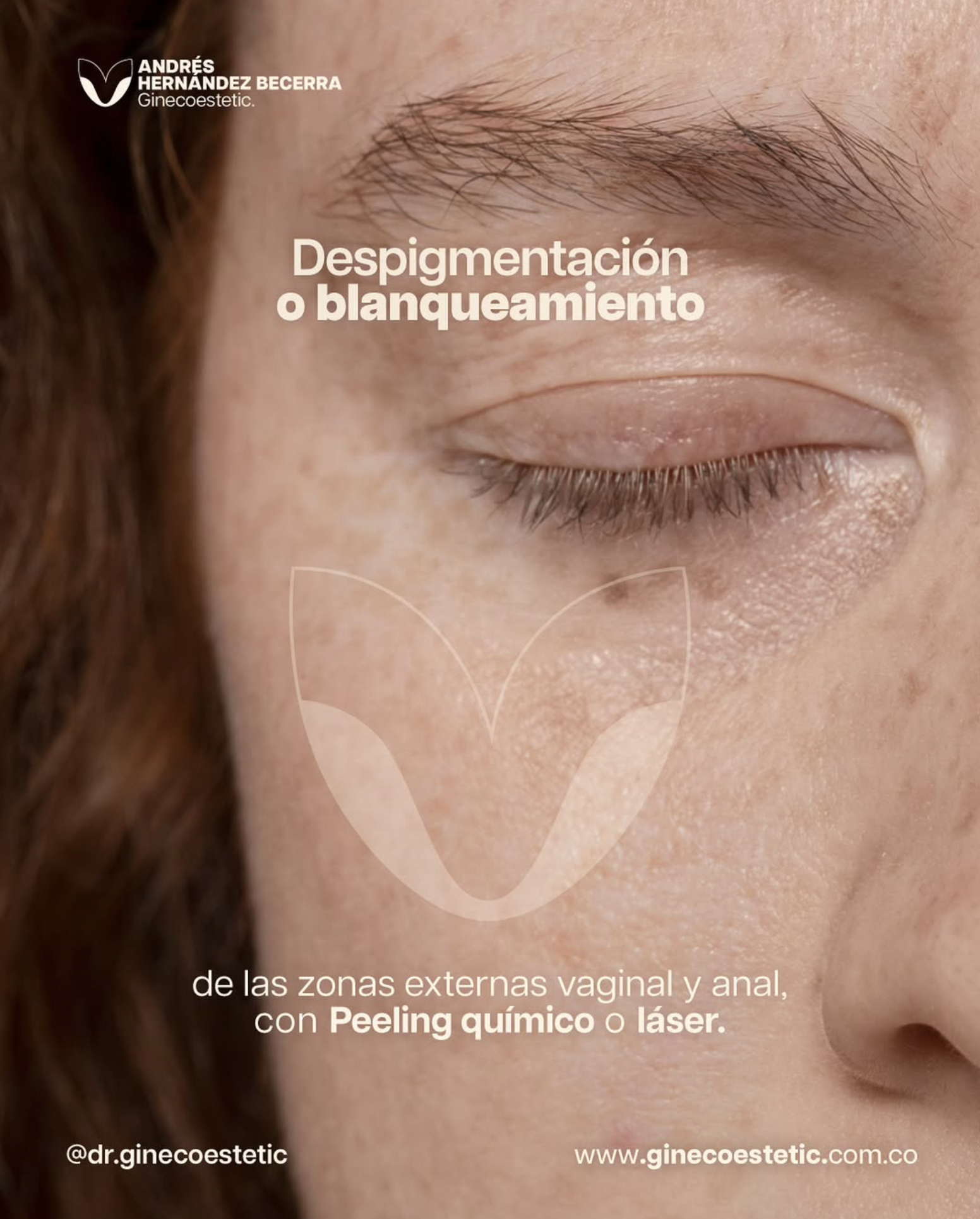 ¿En qué consiste el blanqueamiento genital en Cali? Con el mejor ginecólogo especialista en ginecoestetica de Cali | Tratamiento Para Hombres y Mujeres