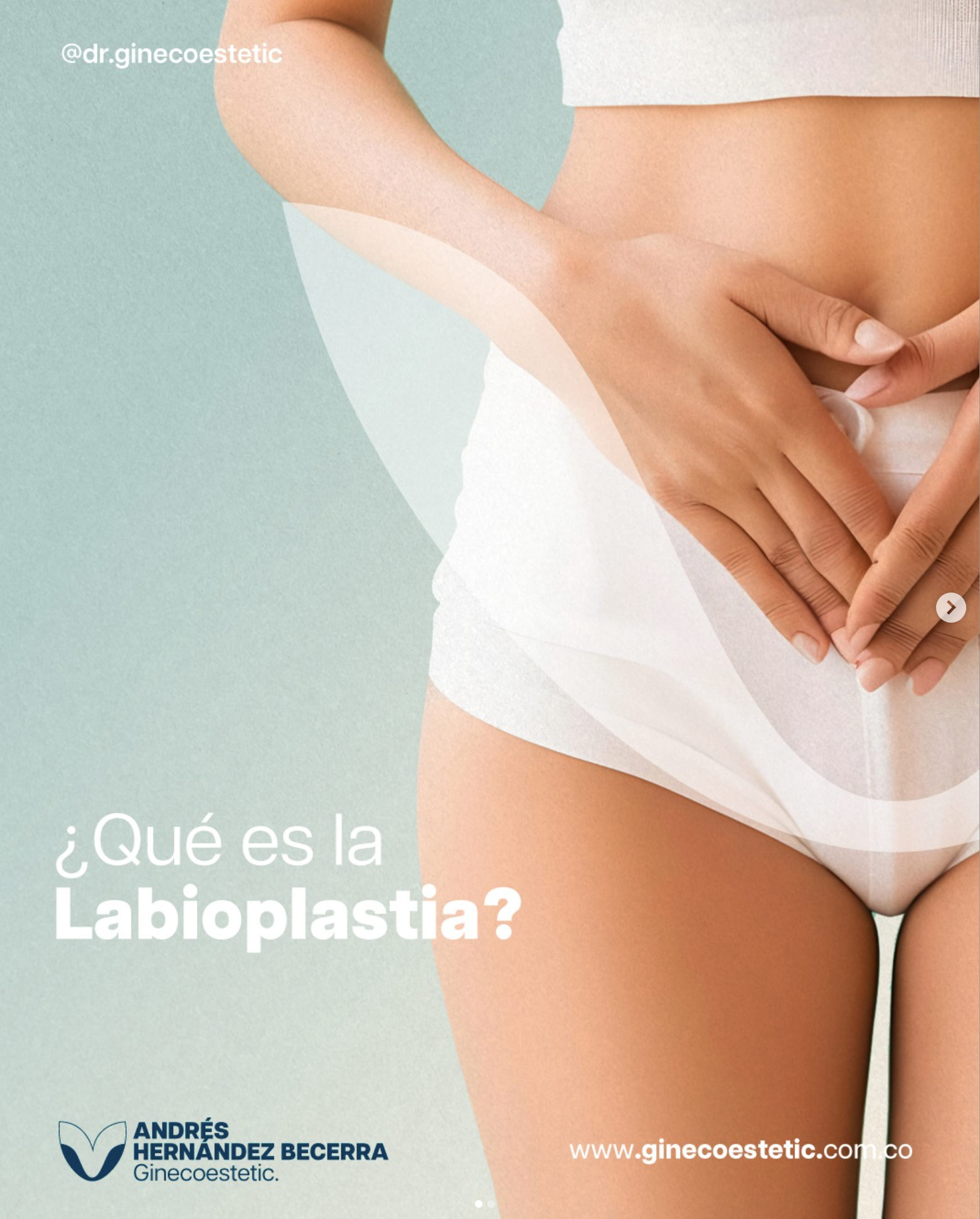 Labioplastia funcional con el mejor Ginecólogo en Cali: una opción para tu bienestar íntimo