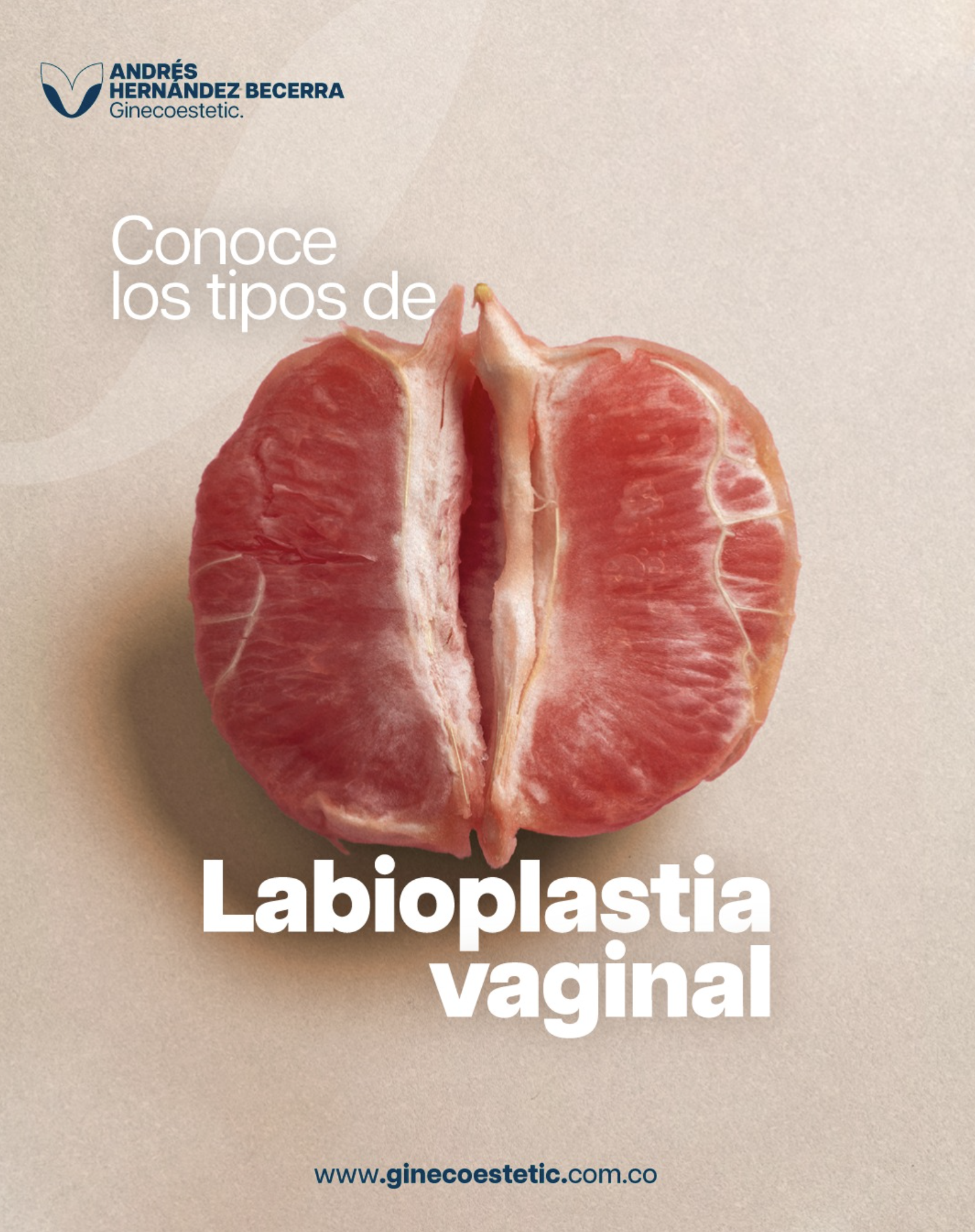 Labioplastia Vaginal con el Mejor ginecólogo en Cali.
