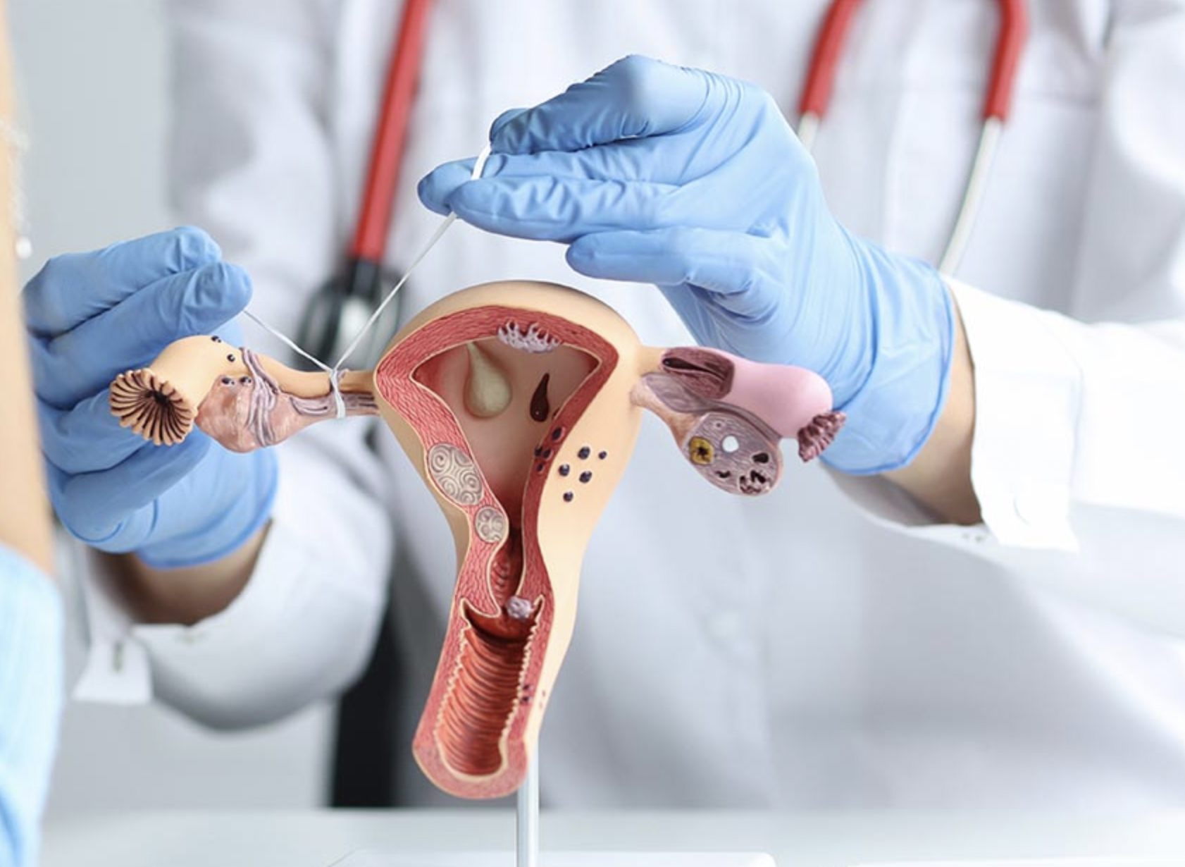 Esterilización Laparoscópica en Cali - Dr. Andrés Hernández Becerra