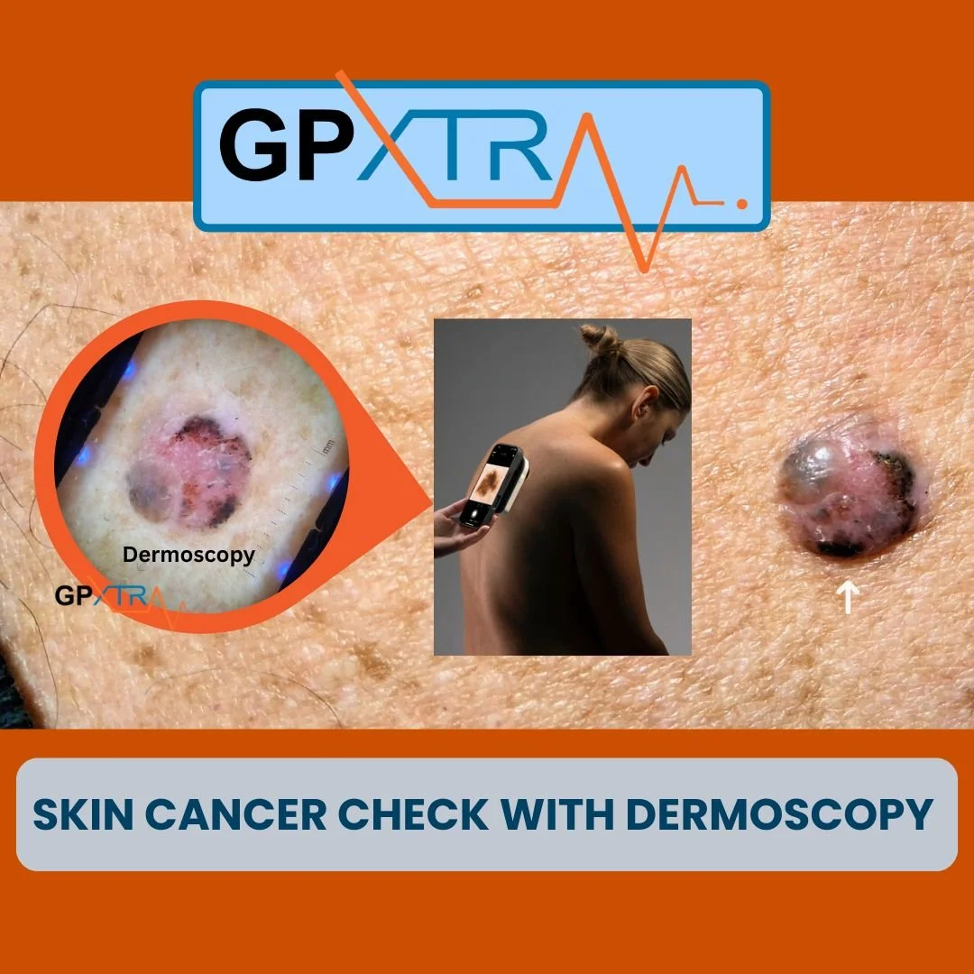 Skin cancer check using dermoscopy at GPXtra