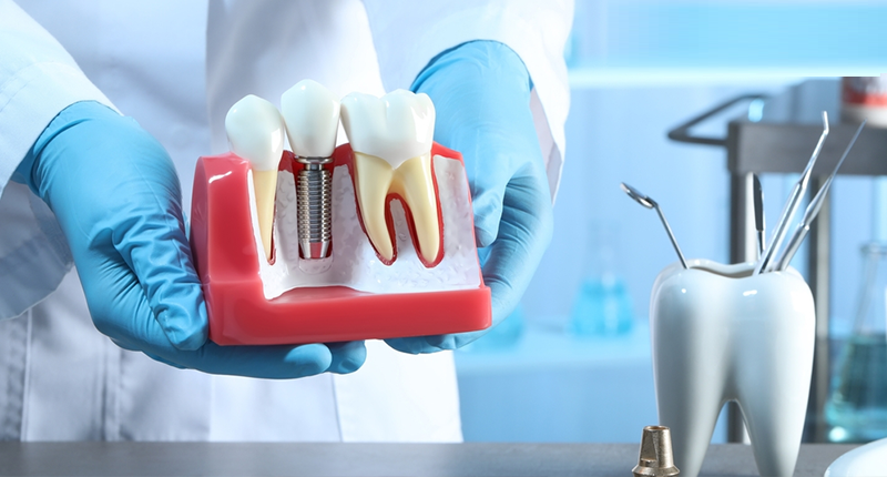 Restoring Smiles with Advanced Implant Care