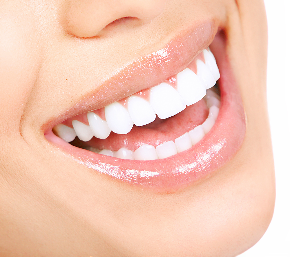 Smile Brighter with Expert Cosmetic Veneers and Crowns in Whittier