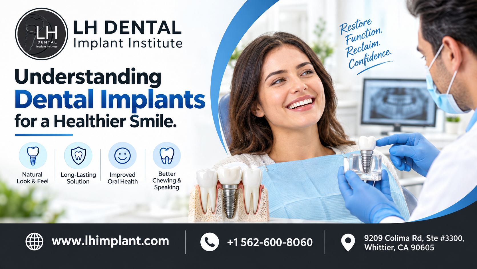 Understanding Dental Implants for a Healthier Smile