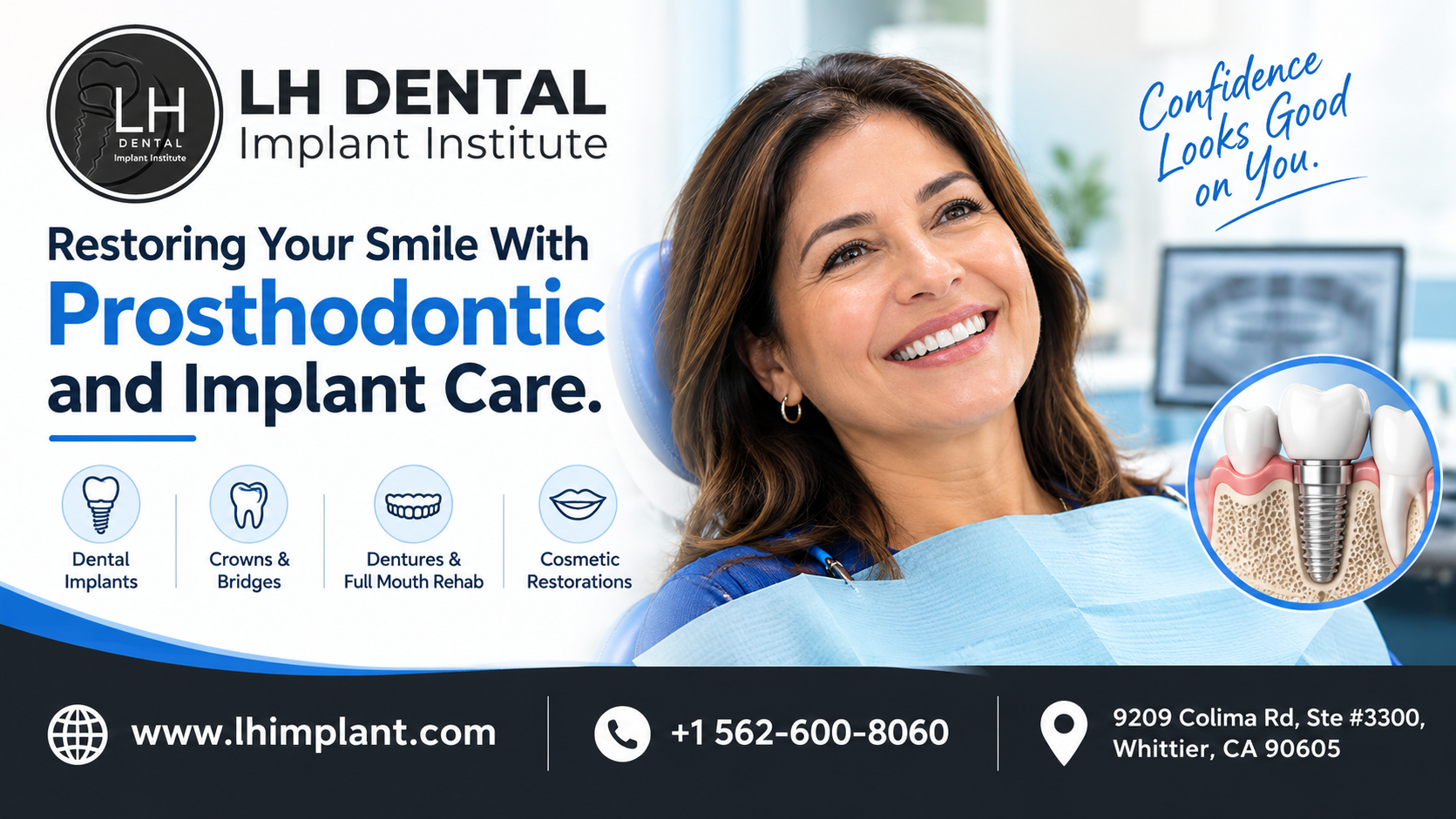 Restoring Your Smile With Prosthodontic and Implant Care