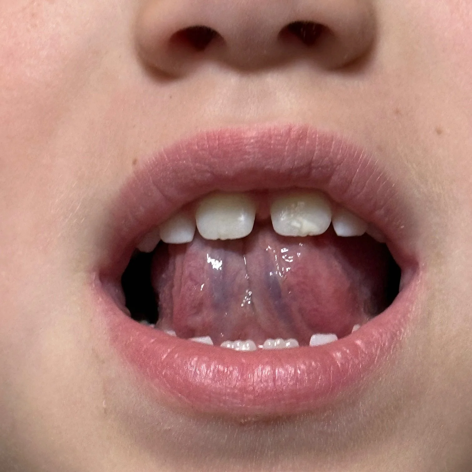 Understanding Lisps: A Parent’s Simple Guide to Clearer Speech ...