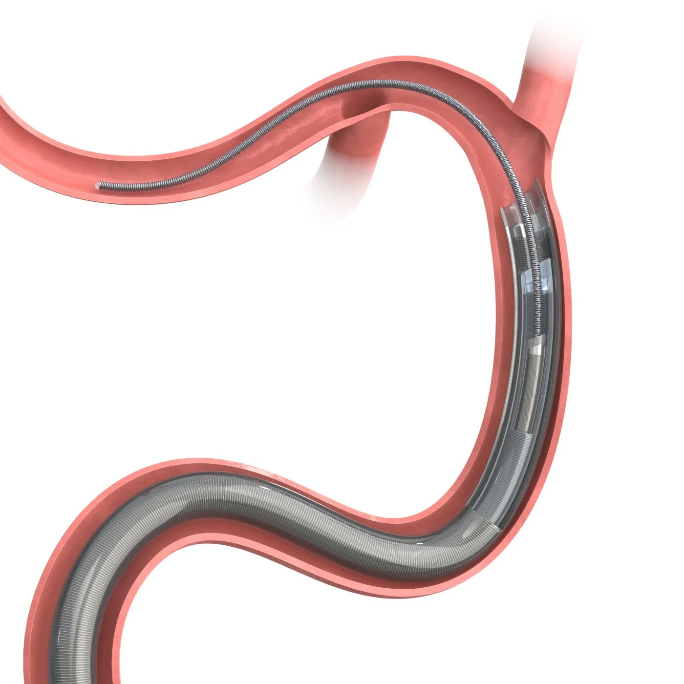 Colossus M2 Diagram, unlabeled rendered edit 8-22-24.jpg