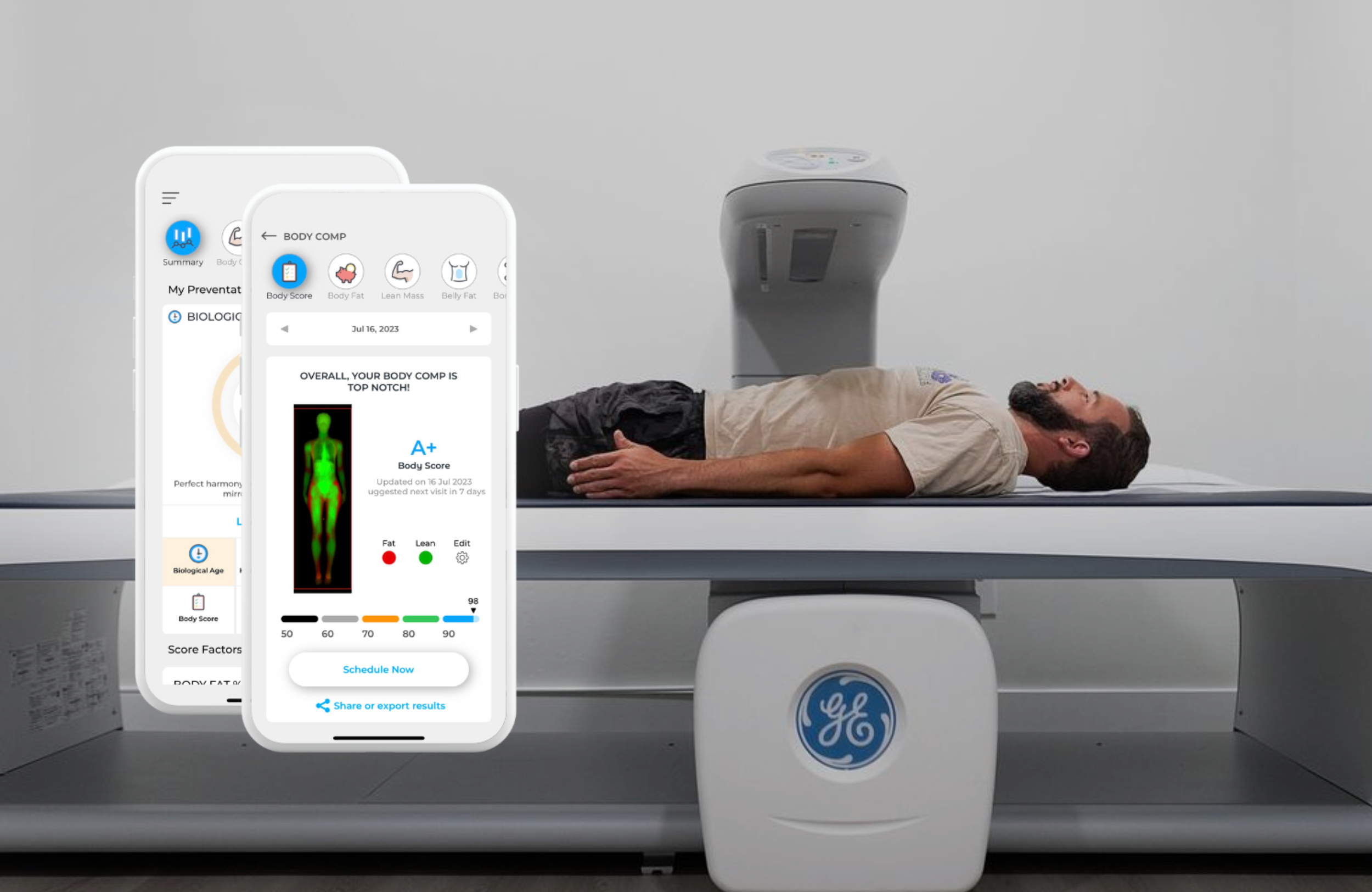 What Your DEXA Report Really Means