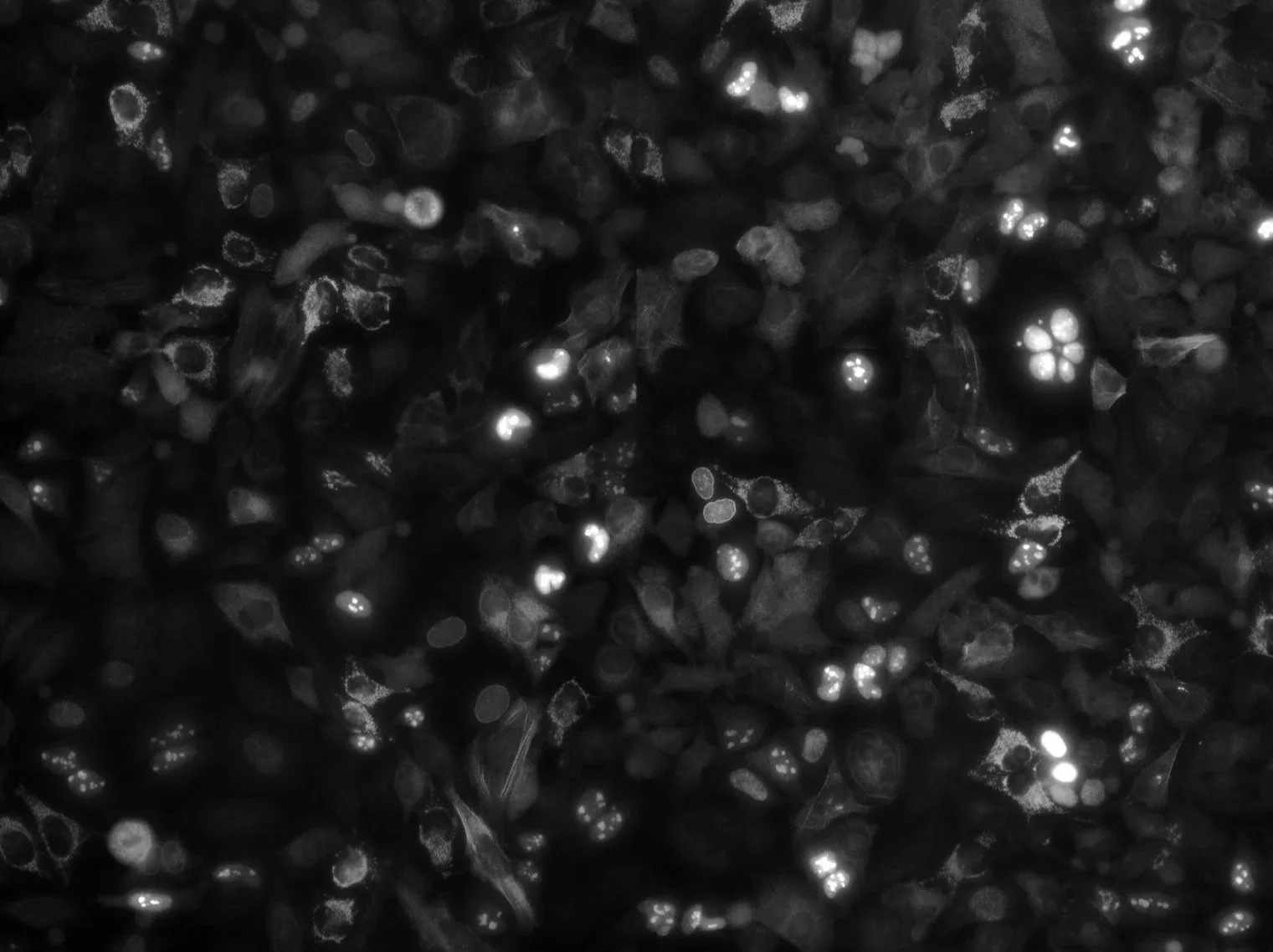 Close-up of small, shiny black berries with a few wispy cobwebs on them.