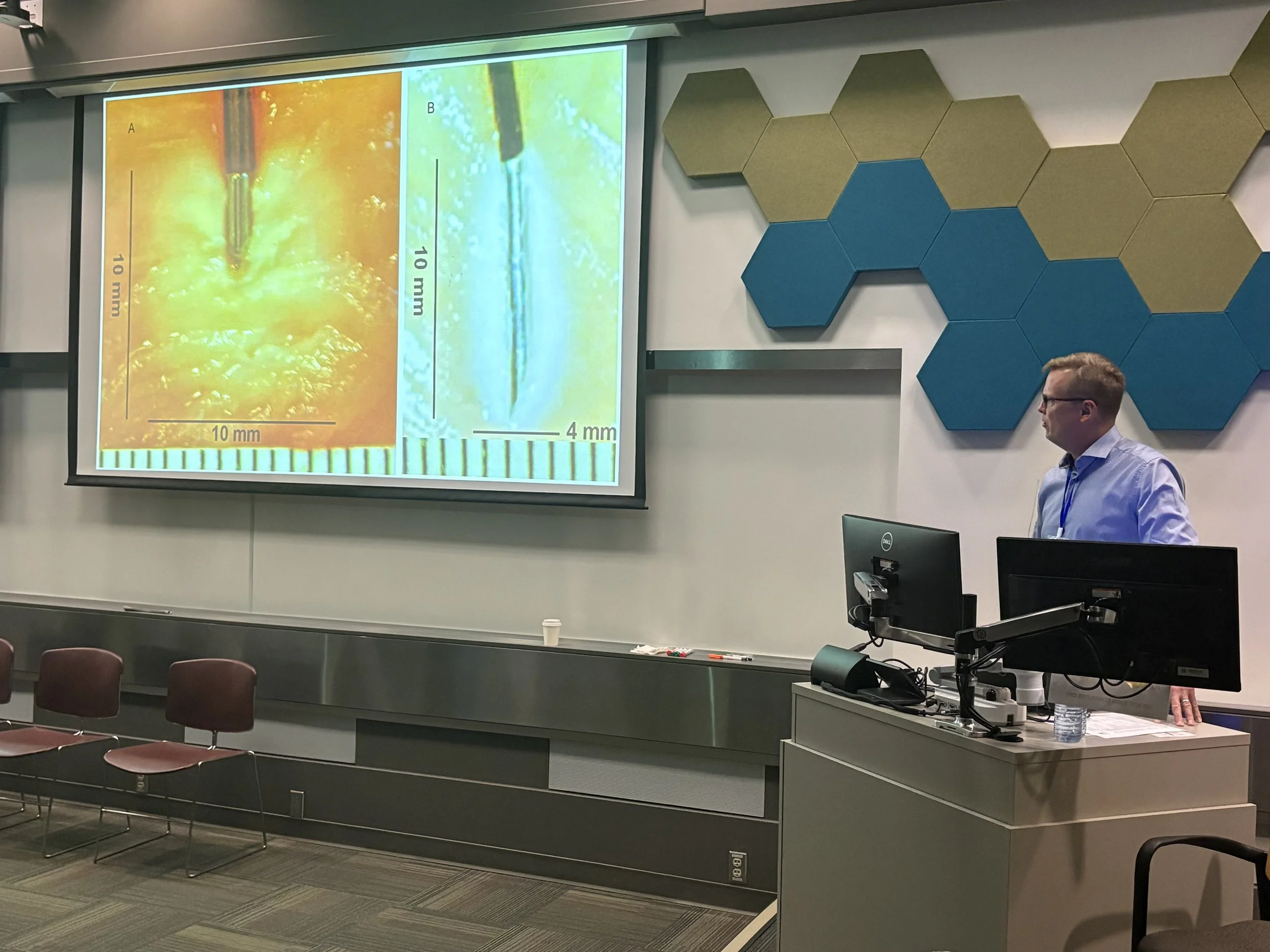 Presentation slide showing a comparison of two images of a needle inside a material, with measurements indicating one image is scaled to 10 millimeters and the other to 4 millimeters. A man in glasses and a light blue shirt stands to the right of the
