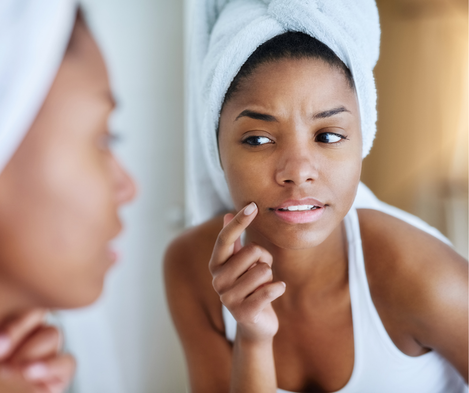 Why Breakouts Are More Common in Summer