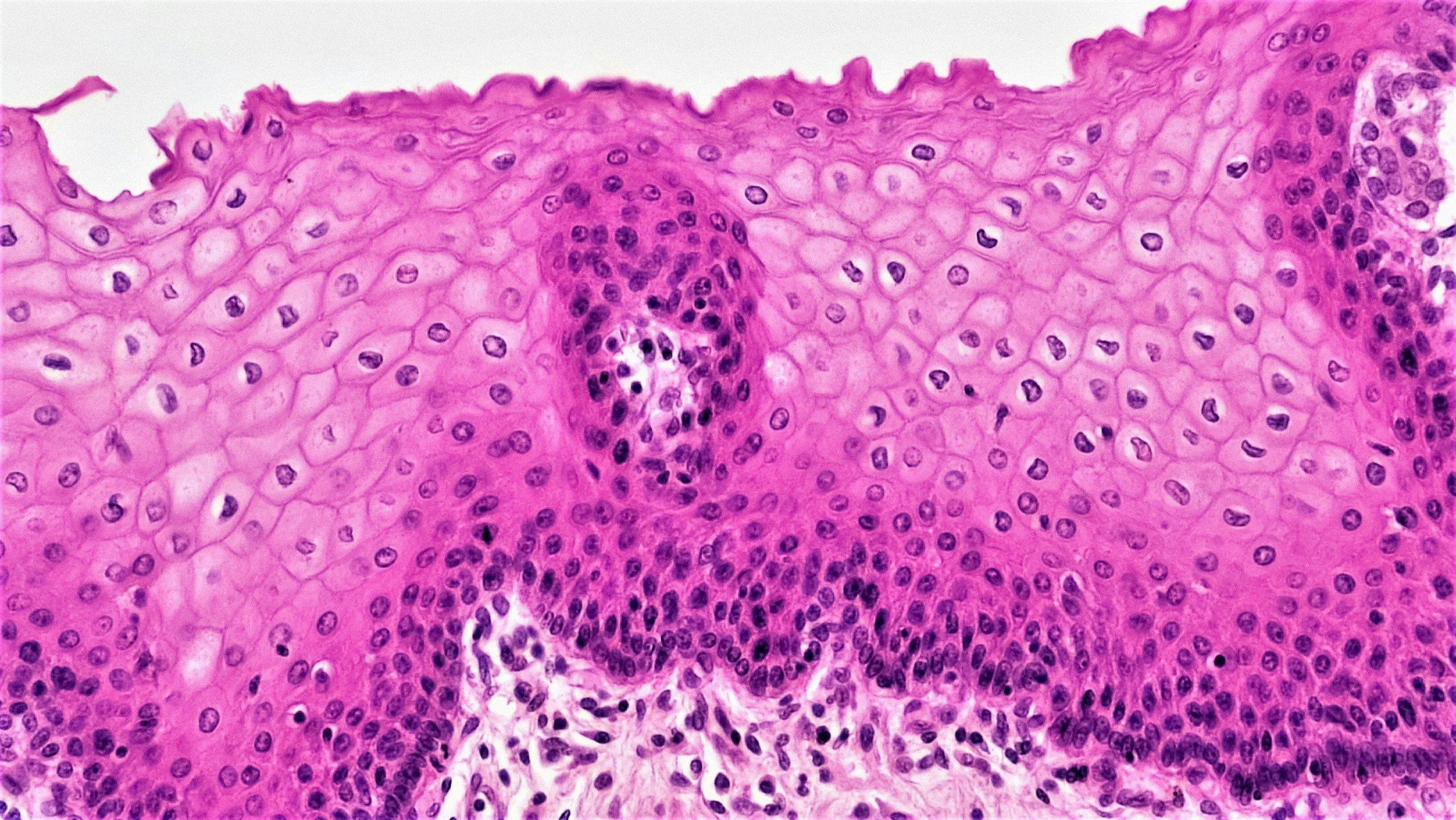 An image showing a dermatologist performing a skin biopsy on a patient's forearm