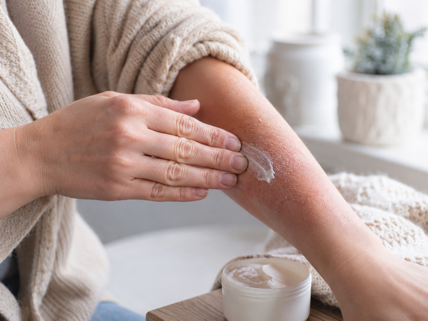 Why Eczema Flares in the Cape Winter — and How to Manage It