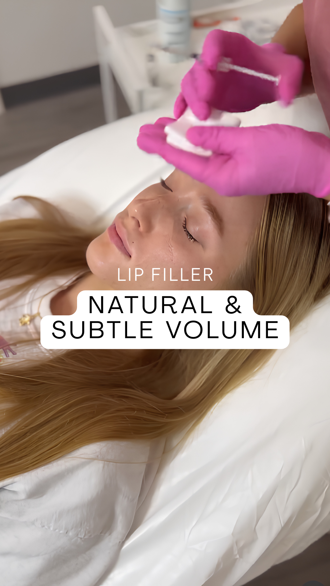 A Natural and Subtle Volume Lip Filler Treatment Video