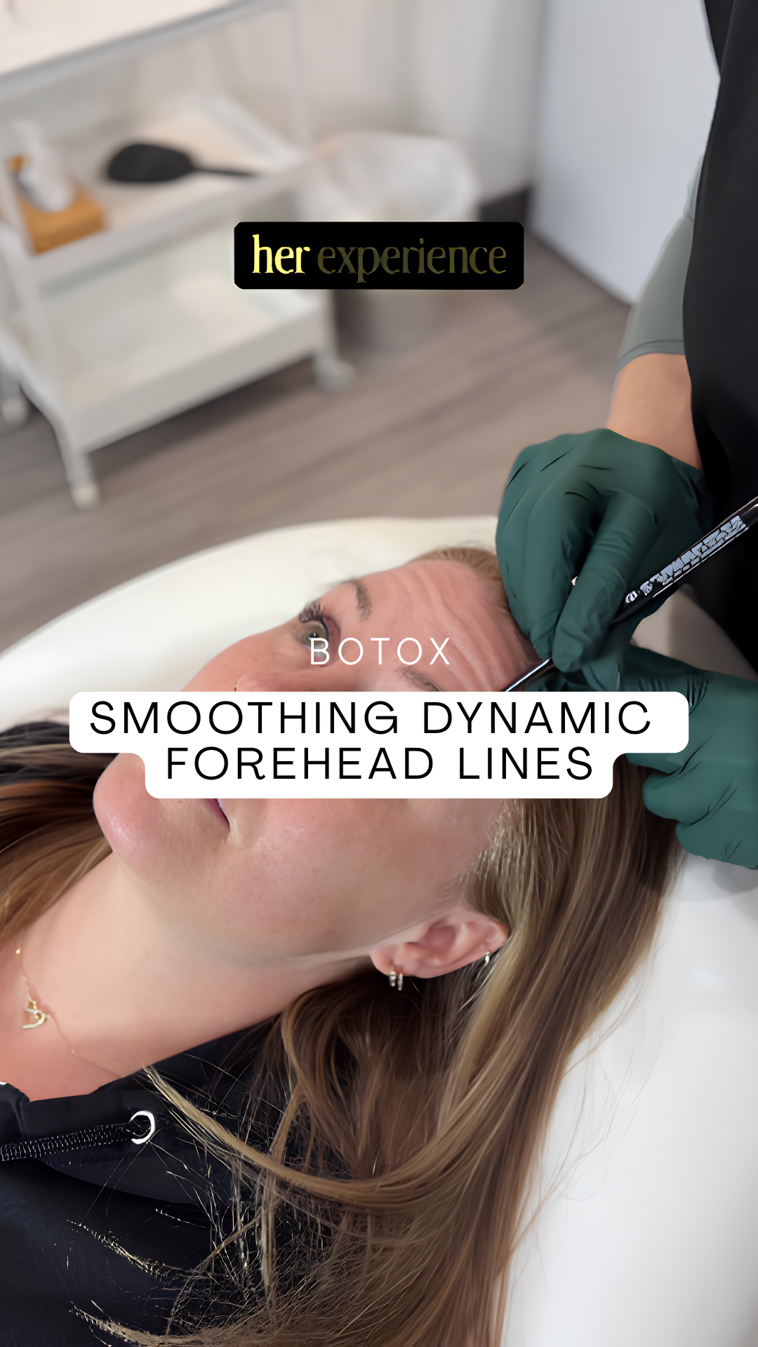 Smoothing Dynamic Forehead lines with Botox by Dr. Kristen Read in Vernon and lake Country, BC