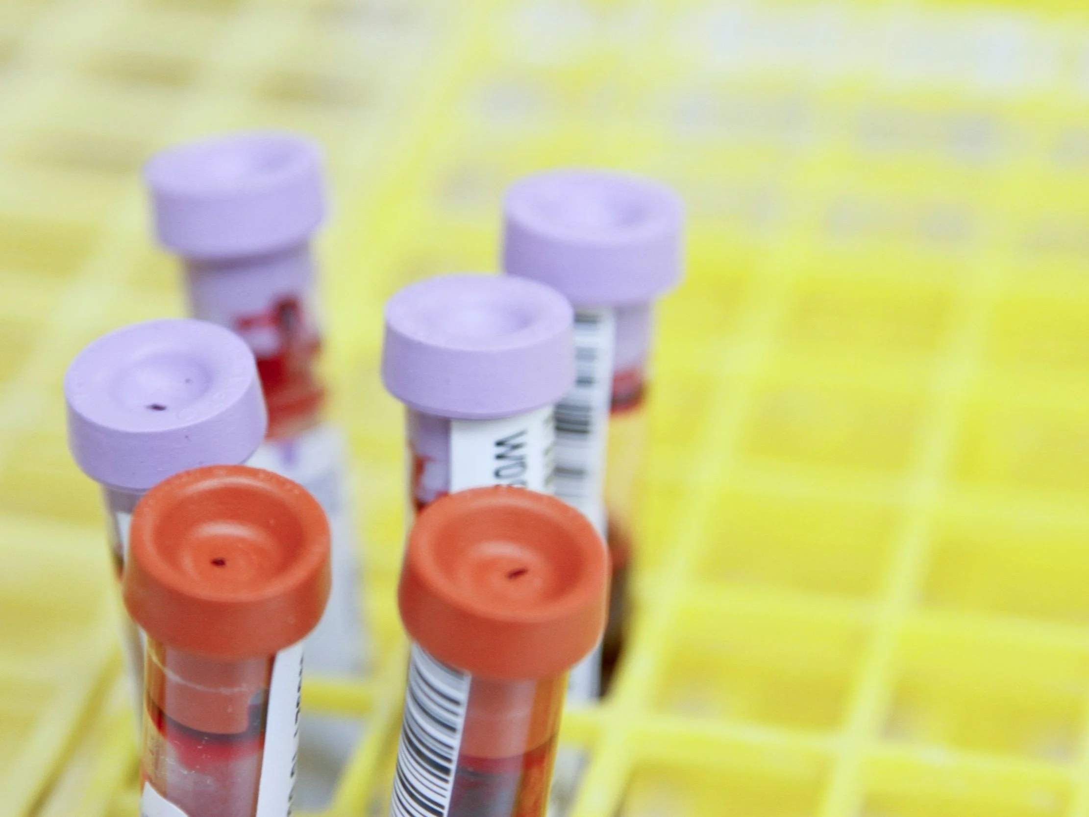 Nevada Battles Low Cancer Screening Rates Amid Push for Innovative Early Detection