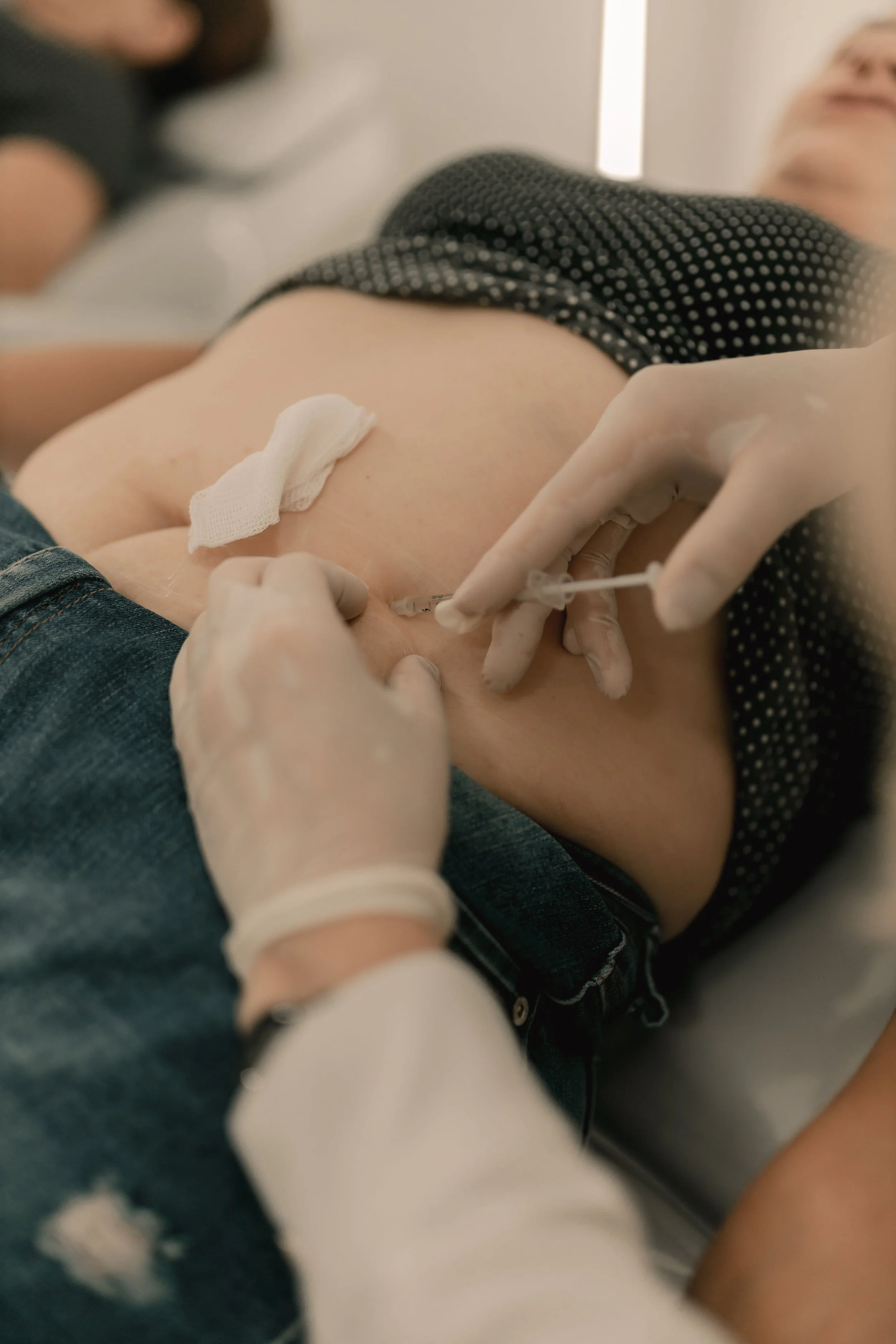Lipoma Removal Sydney | Forearm Lipoma Excision | Key Health Medical Centre