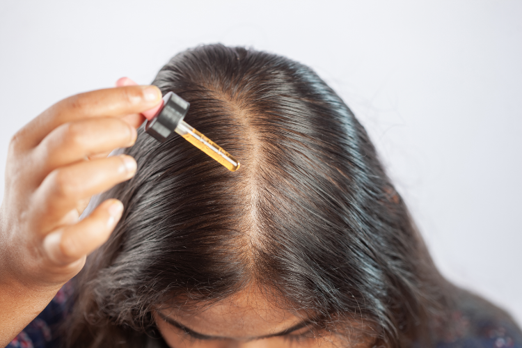 Compounded Minoxidil & Finasteride Pharmacy in Washington, DC: Hair-Loss Options