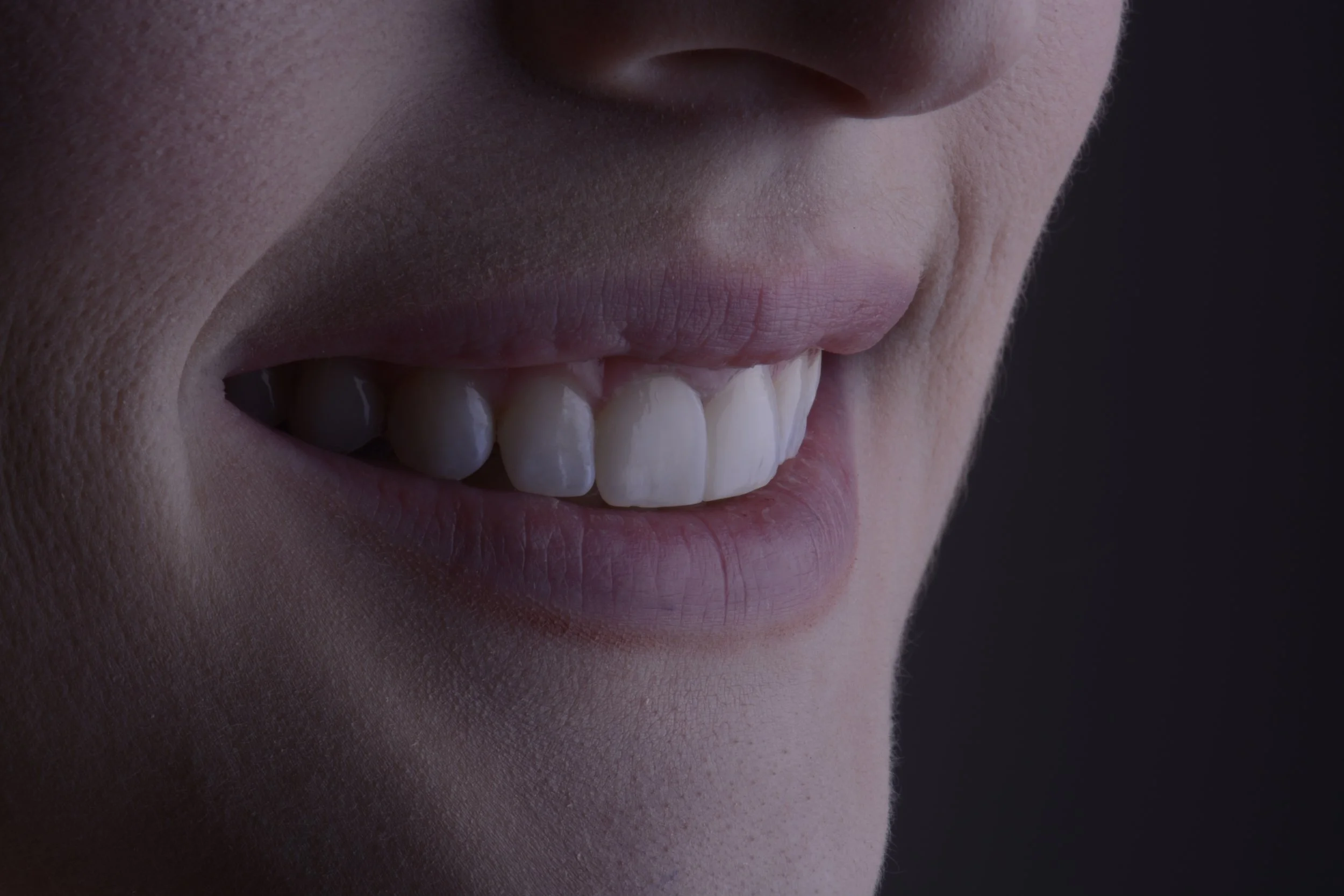 The Growing Popularity of Minimalist Cosmetic Dentistry