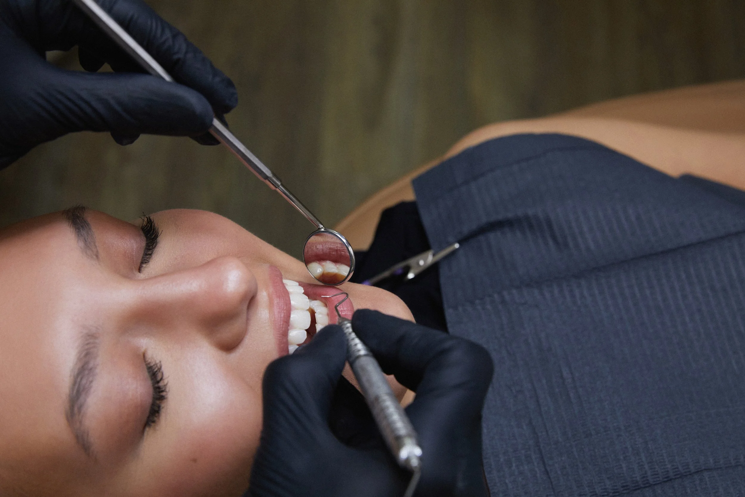 How to Fix a Gummy Smile in San Antonio