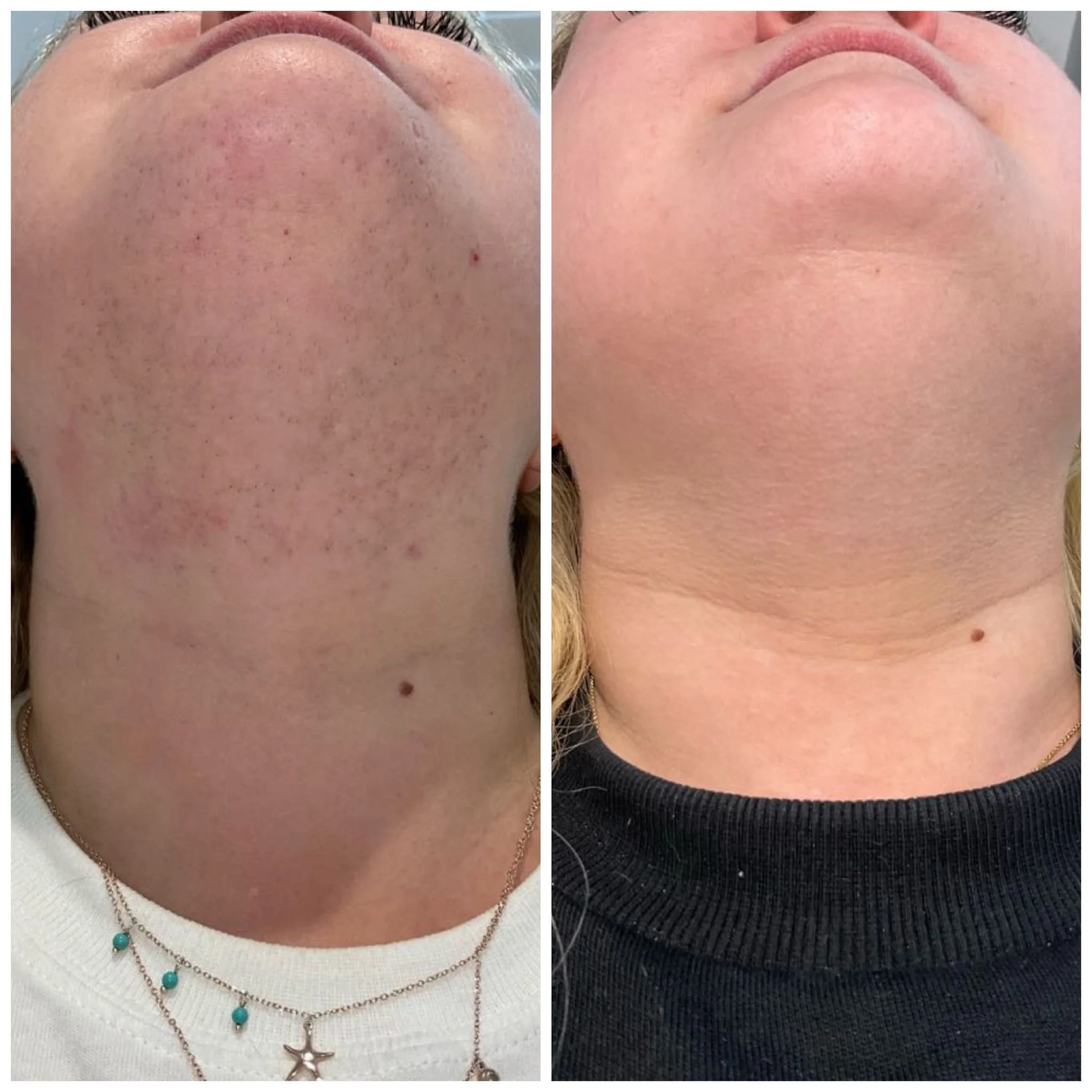 Before & After Photo.jpg