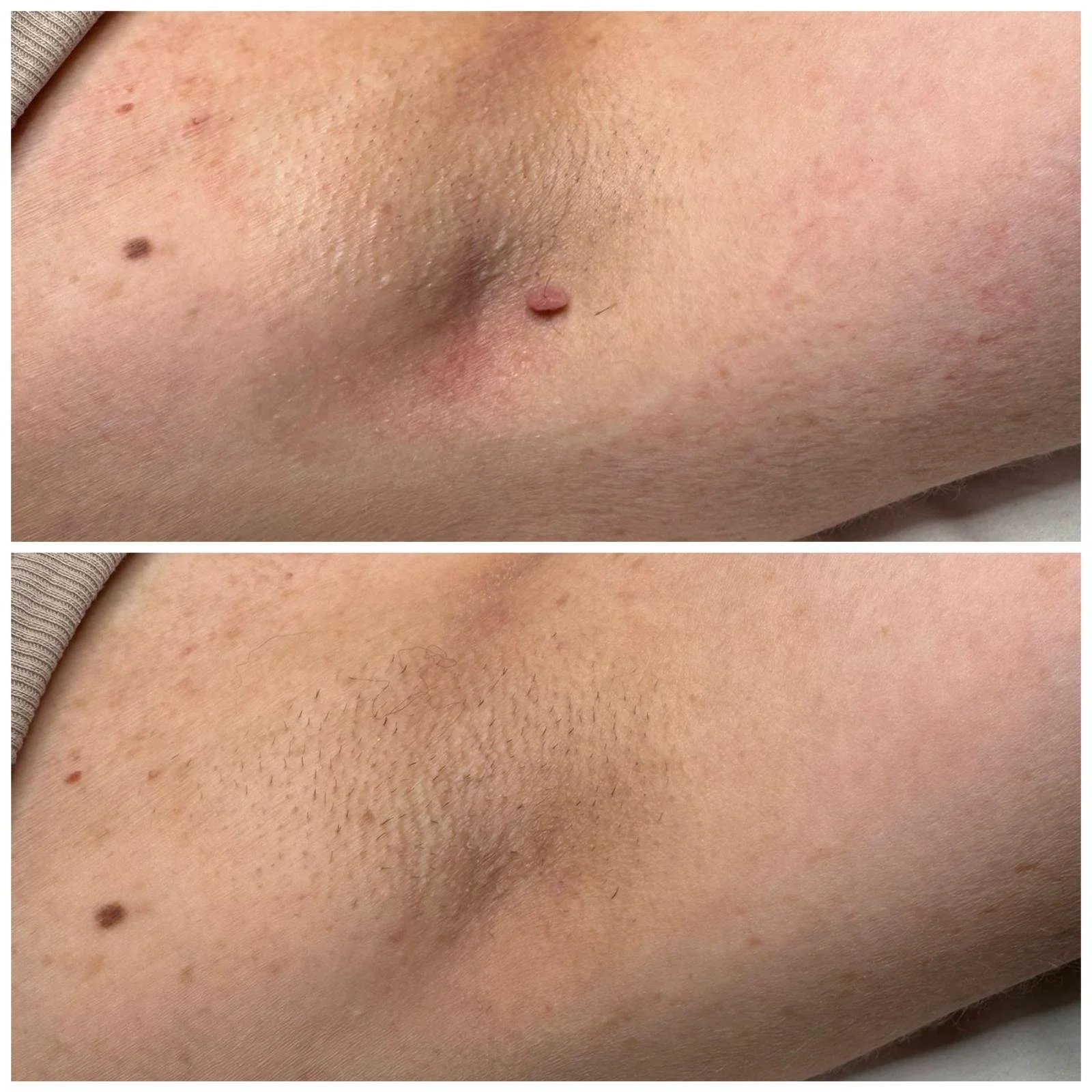 Before & After 1.jpeg