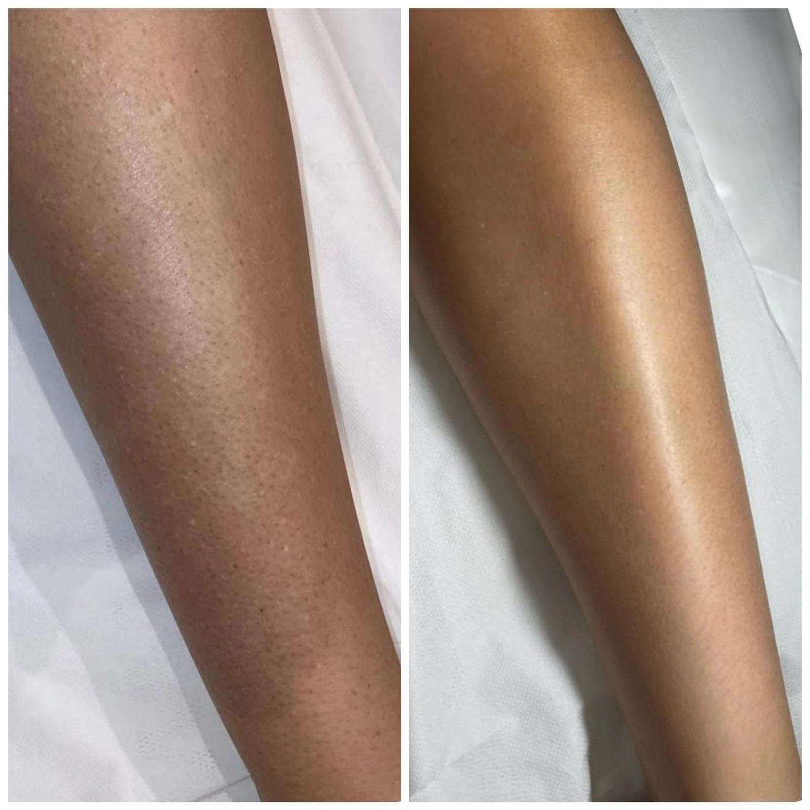 Client Before & After Photo...jpg