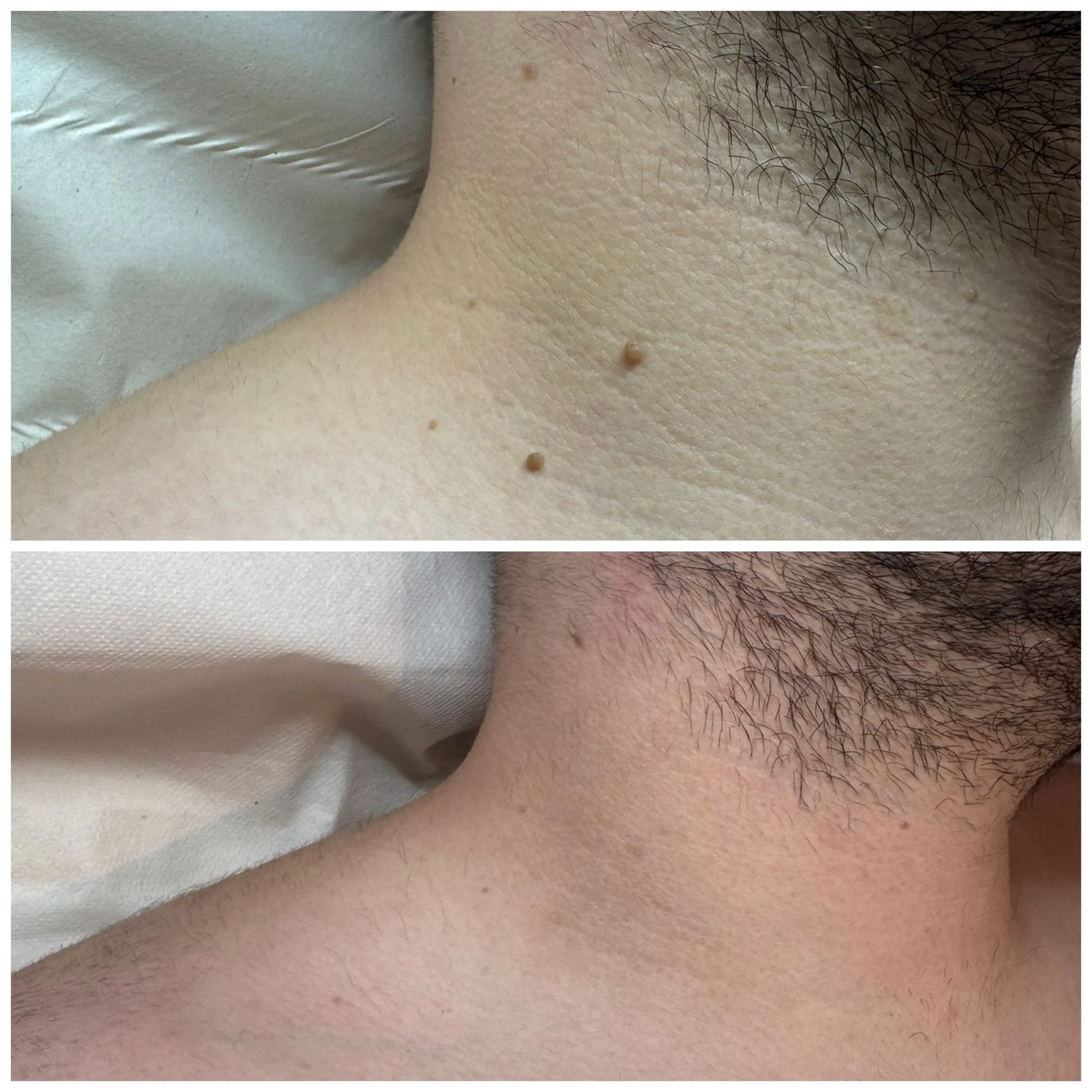 Before & After Carl.jpeg