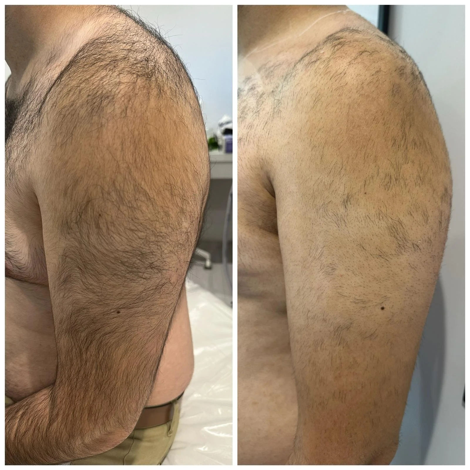 Client Progress After 1 Session