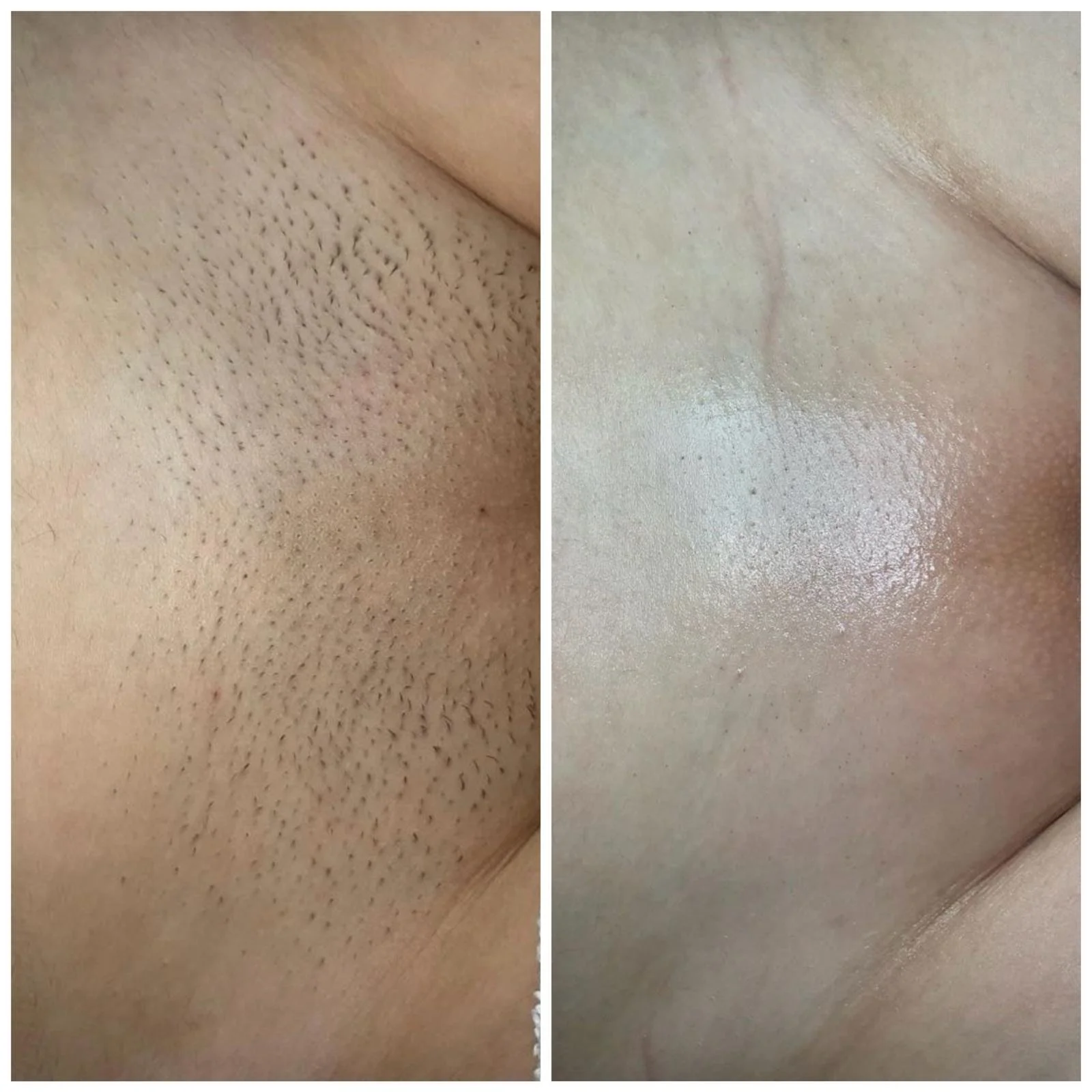 Client Before & After Photo.jpg