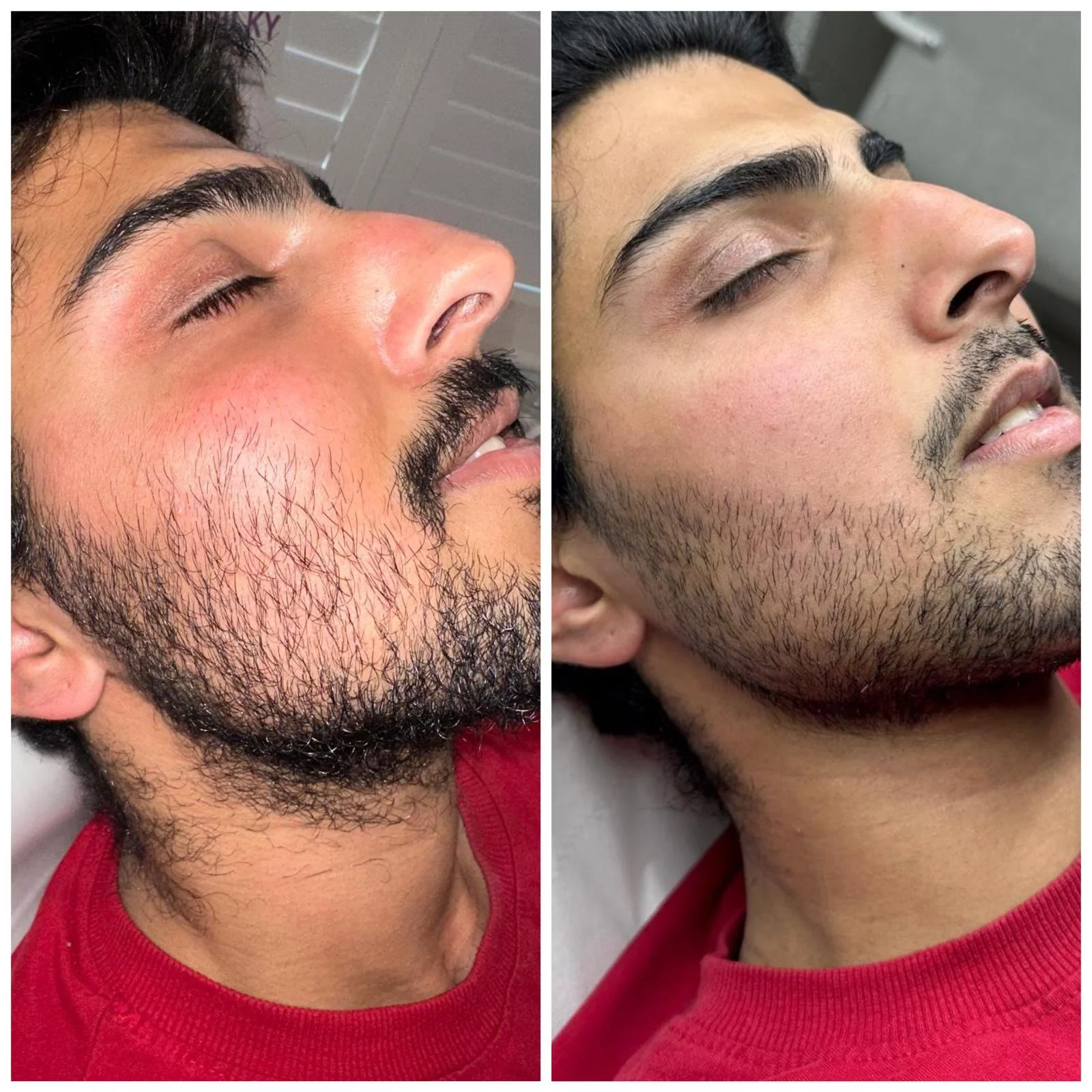 Client Progress After 3 Sessions