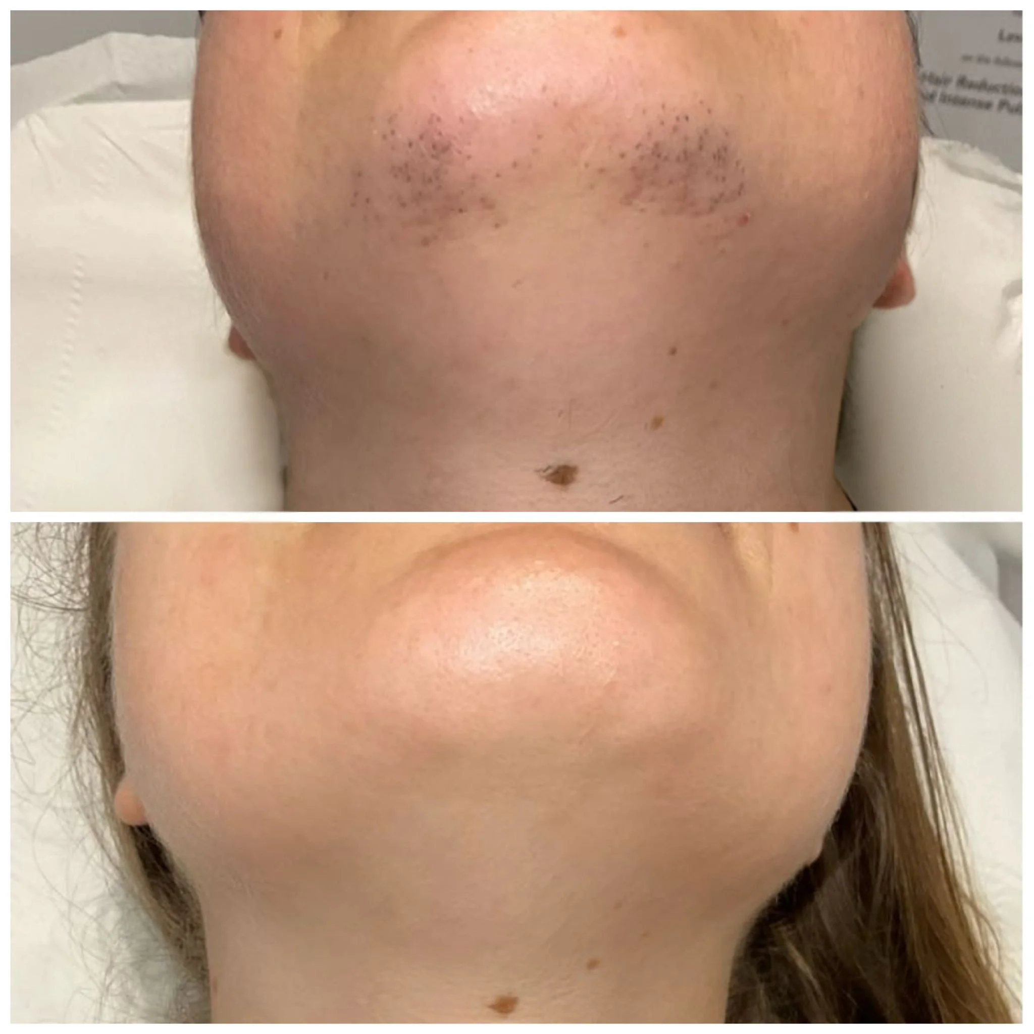 Client Before & After - Face (2).jpg