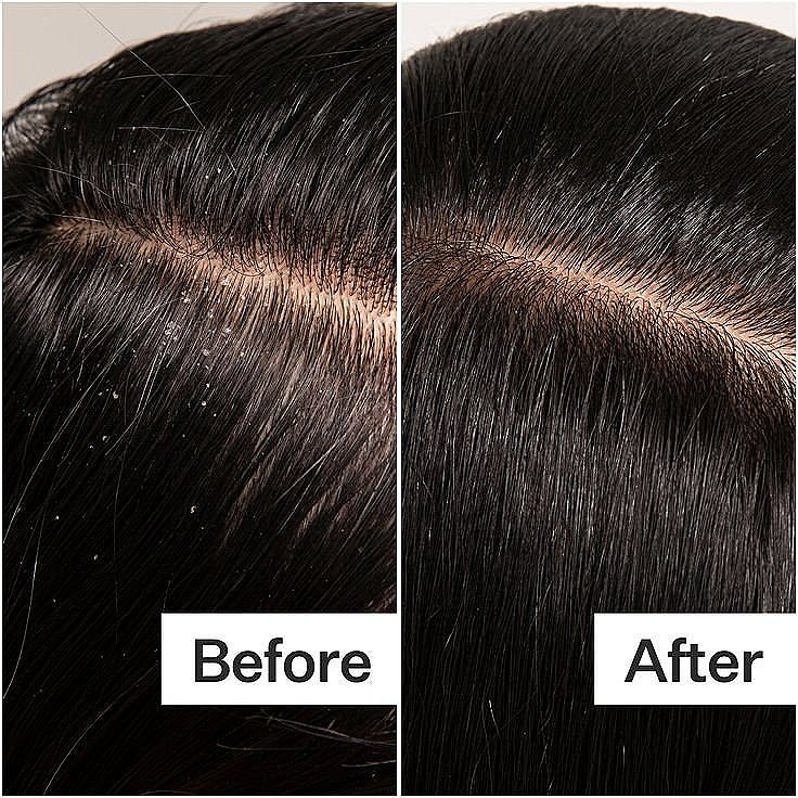 Scalp+Detox+Oil.jpg