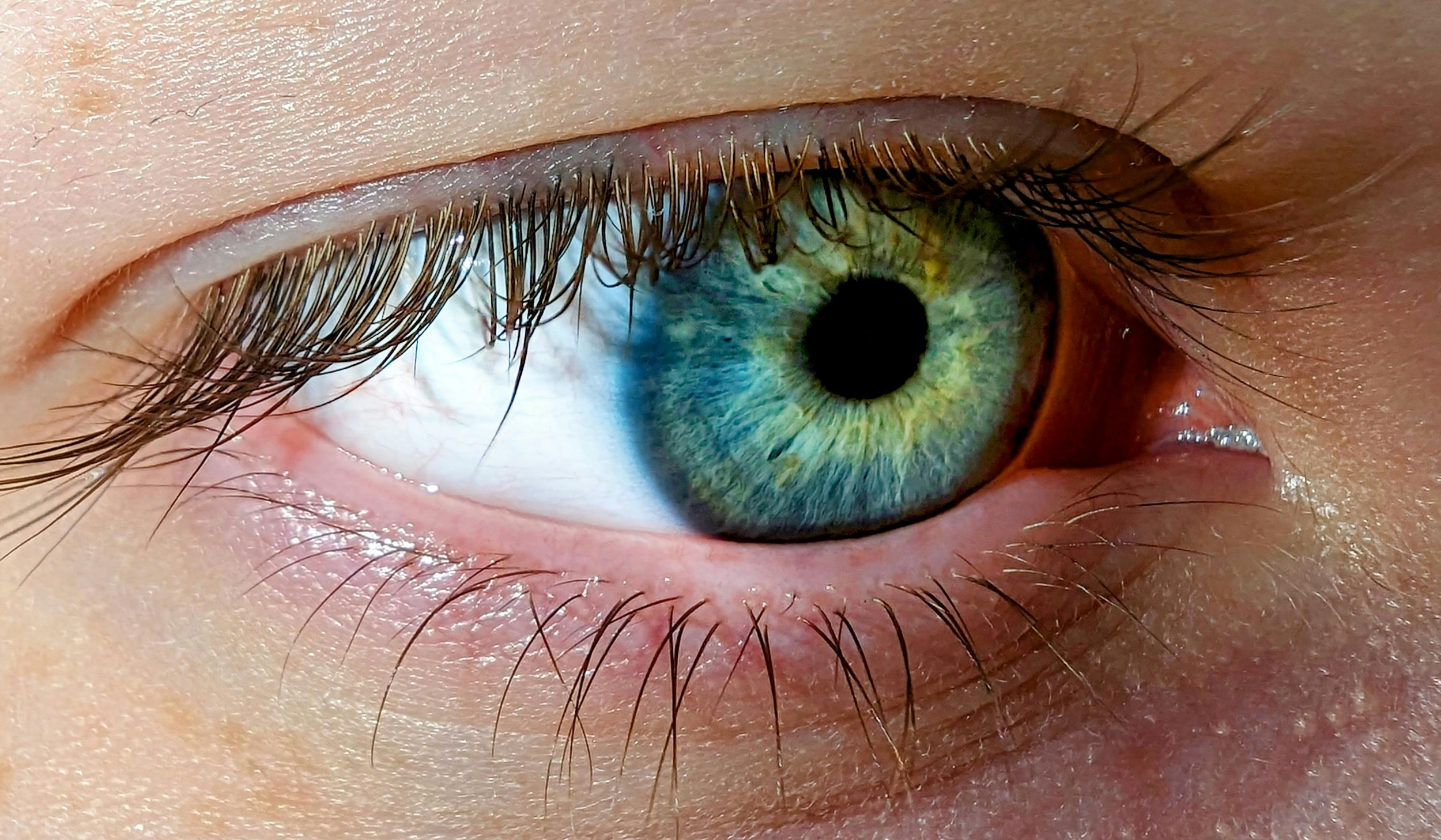How EMDR Therapy Helps the Brain Heal From Trauma