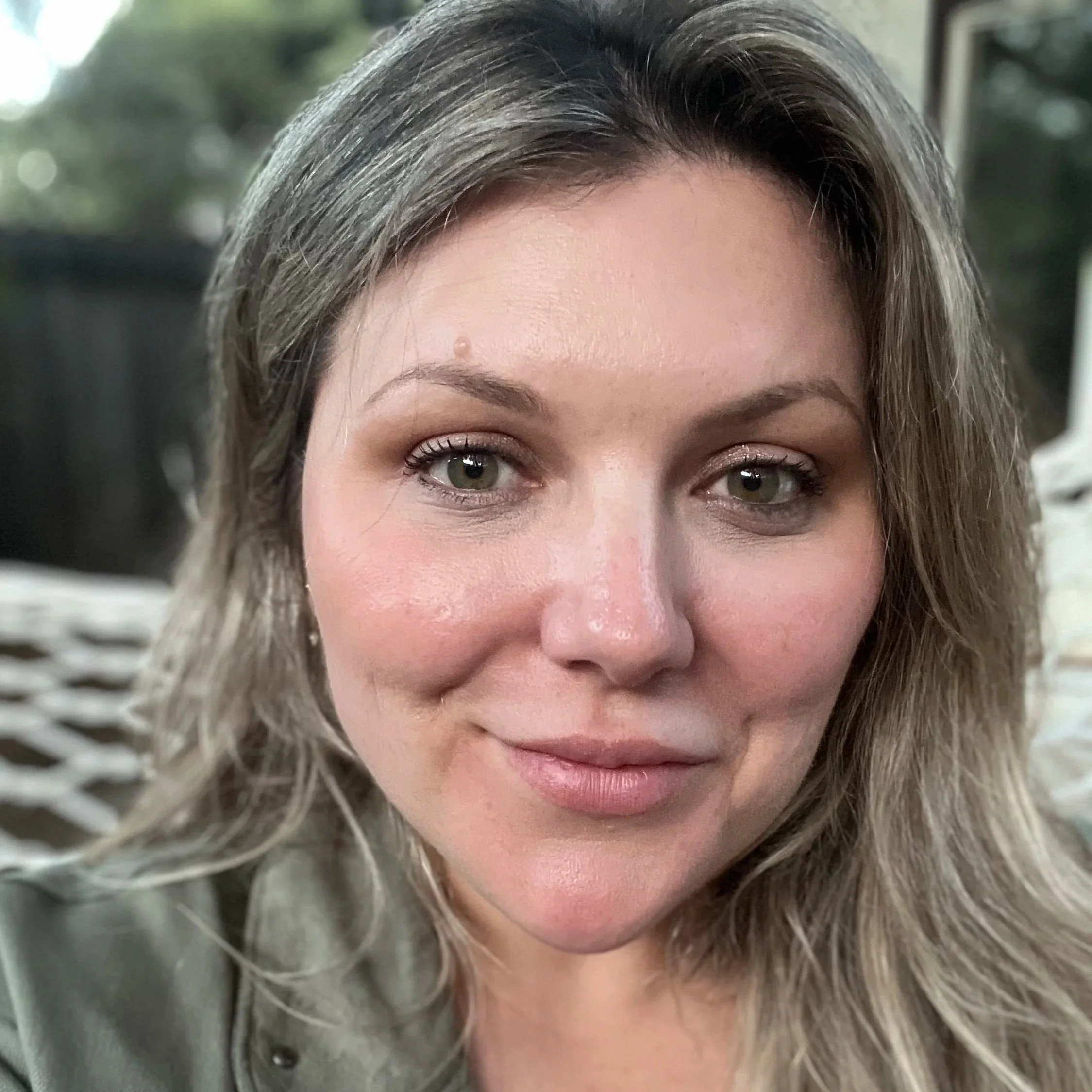 After Daxxify® full face