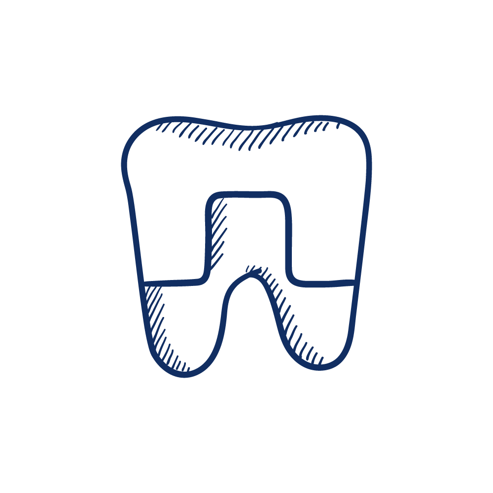 Brighton Dental Group, BDG, Brighton dentist, Dentist near me, Bayside dentist, dentist Brighton, Friendly dentist, Family dentist, crowns, Teeth whitening, Dental clean, orthodontist, wisdom teeth removal, root canal treatment, dentures, implants