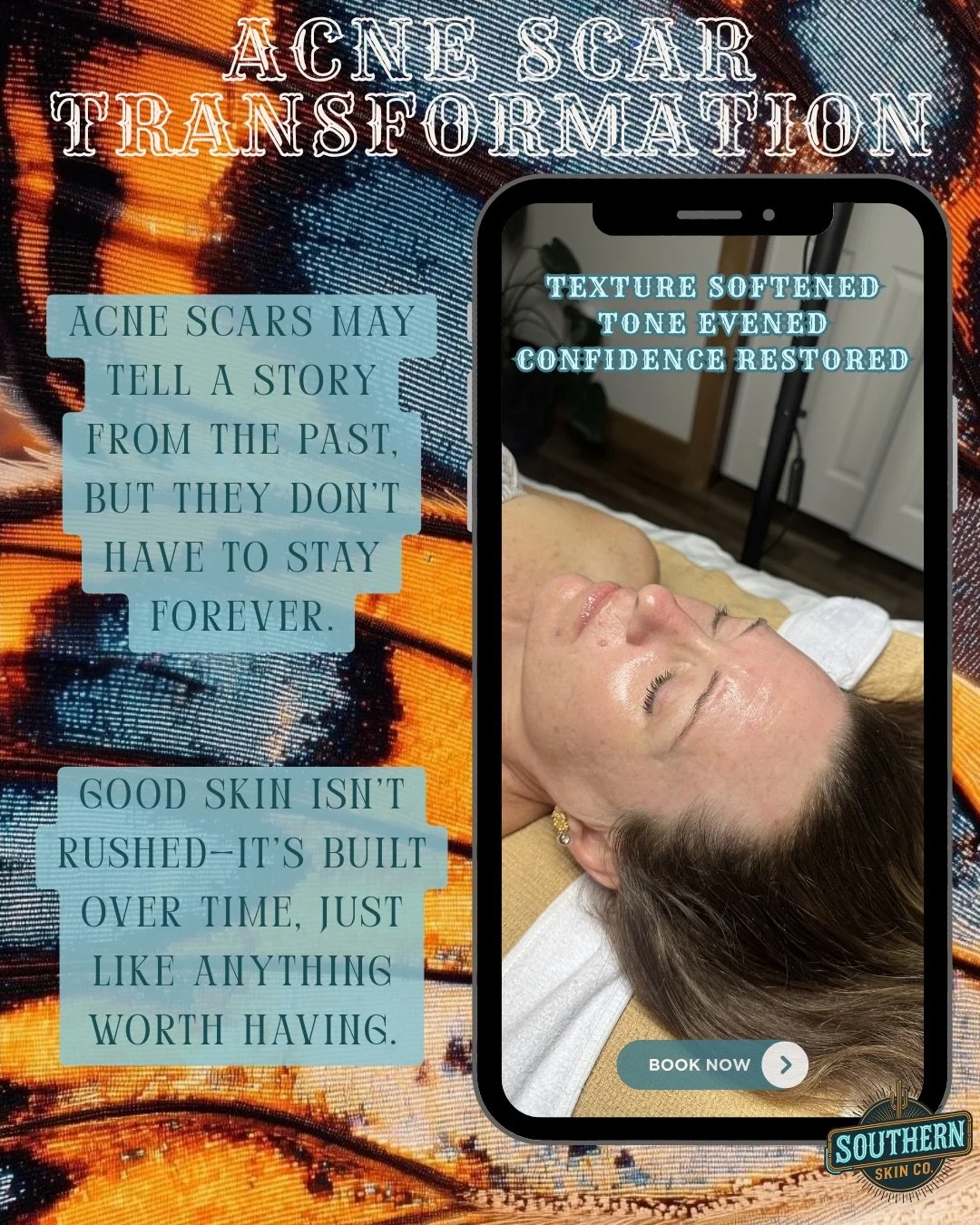 Minimal Downtime 🚨Maximum Results‼️

The service that heals from the inside out &amp; never disappoints 

🚨 1-3 hour downtime 
🚨 forces your skin to heal itself 
🚨 increases collagen &amp; elastin production
🚨 improves &amp; smoothes texture 
🚨