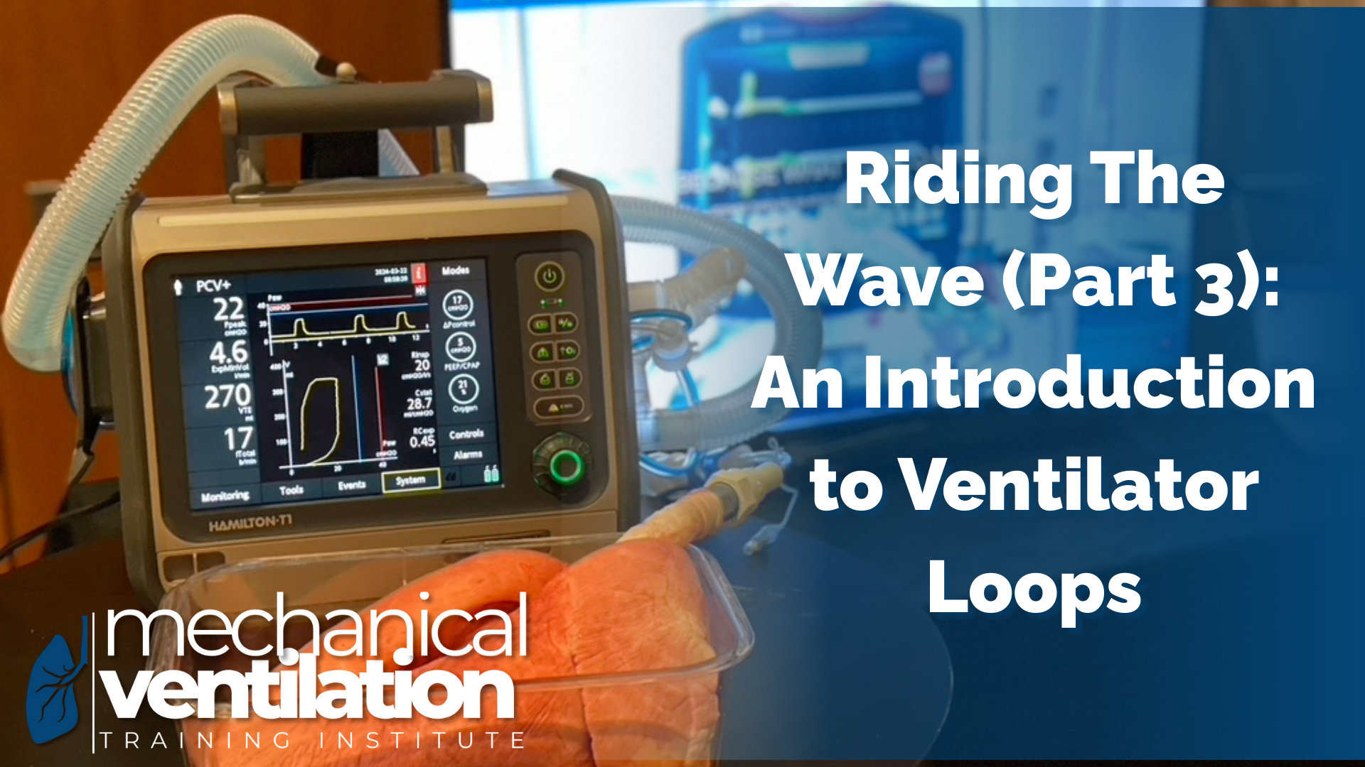 Riding the Wave (Part 2): Applying Scalar Graphs to Patient Care