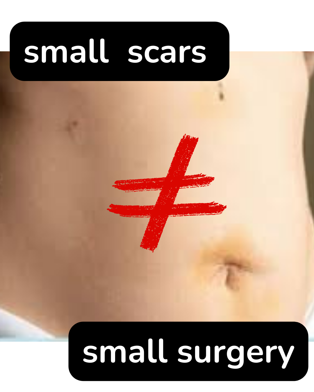 Why You Still Don't Feel Like Yourself After Your Hysterectomy (And Why That's Not a You Problem)