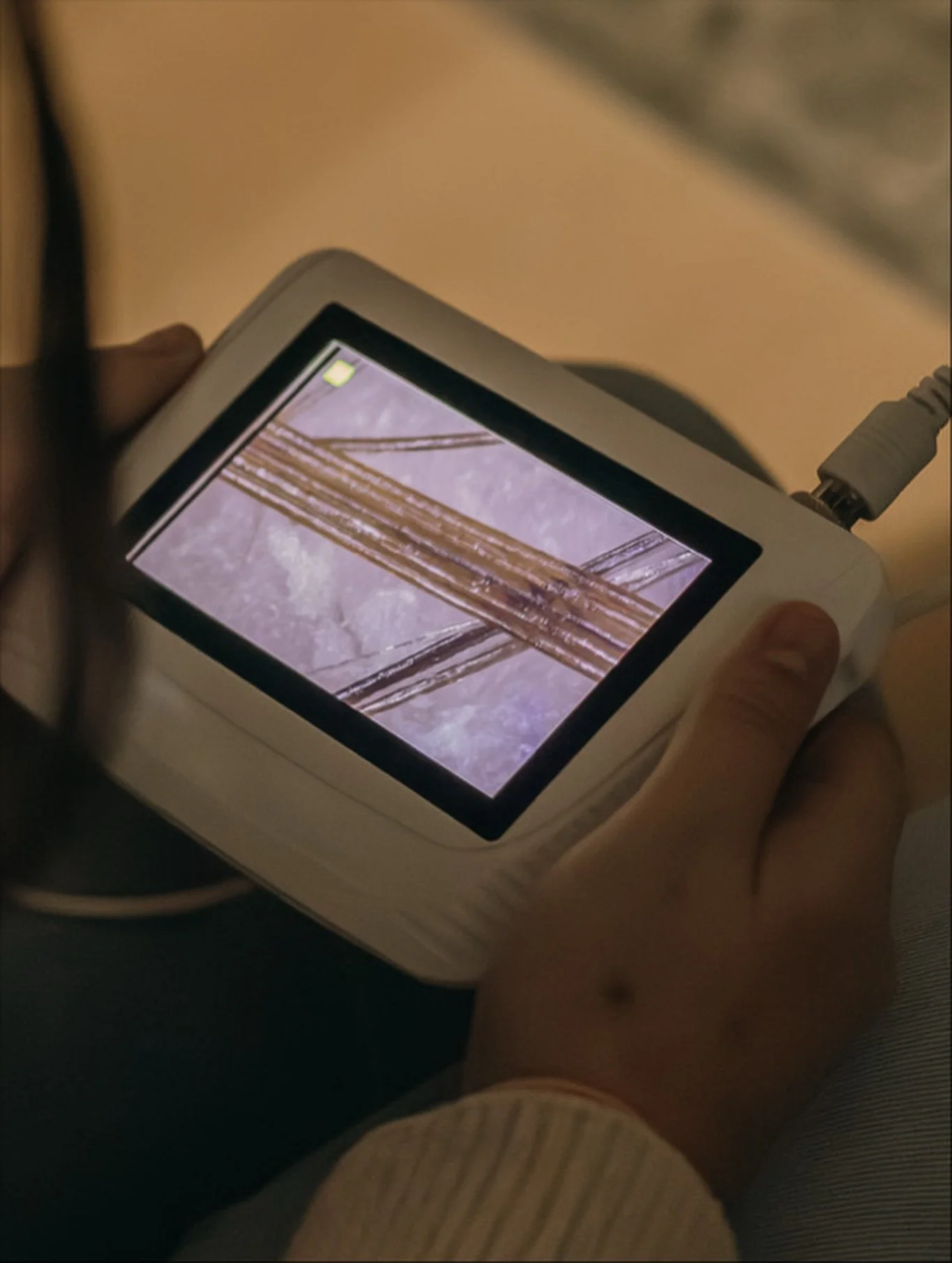 Ever wondered what your scalp really looks like? 

Our scalp camera gets up close and personal to show everything- your true hair color, buildup you didn&rsquo;t know was there, how thick/thin your hair follicles really are, and what your scalp actua