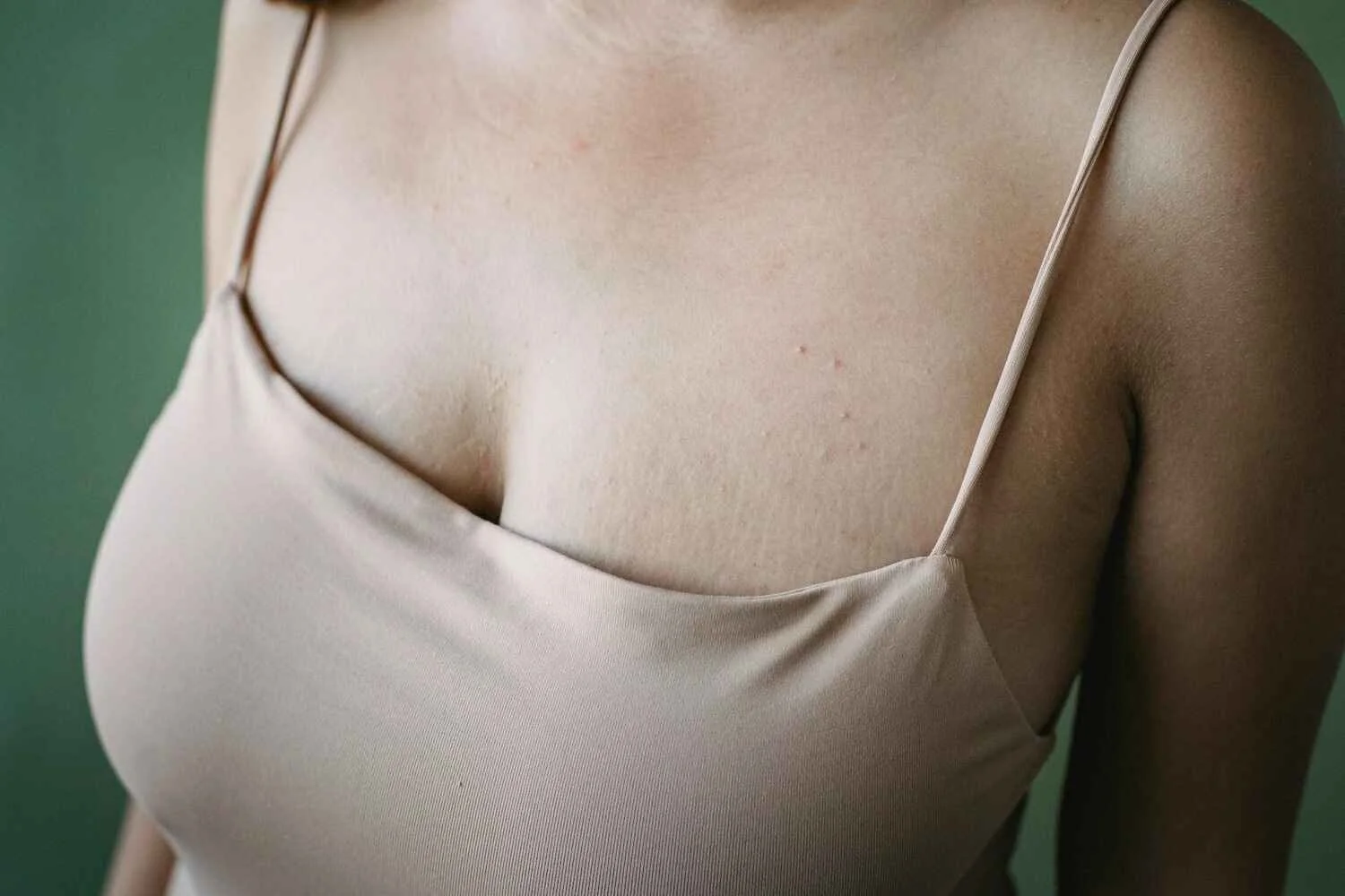 Woman in a nude camisole before a breast lift consultation with Dr. Aline Rau in Denver