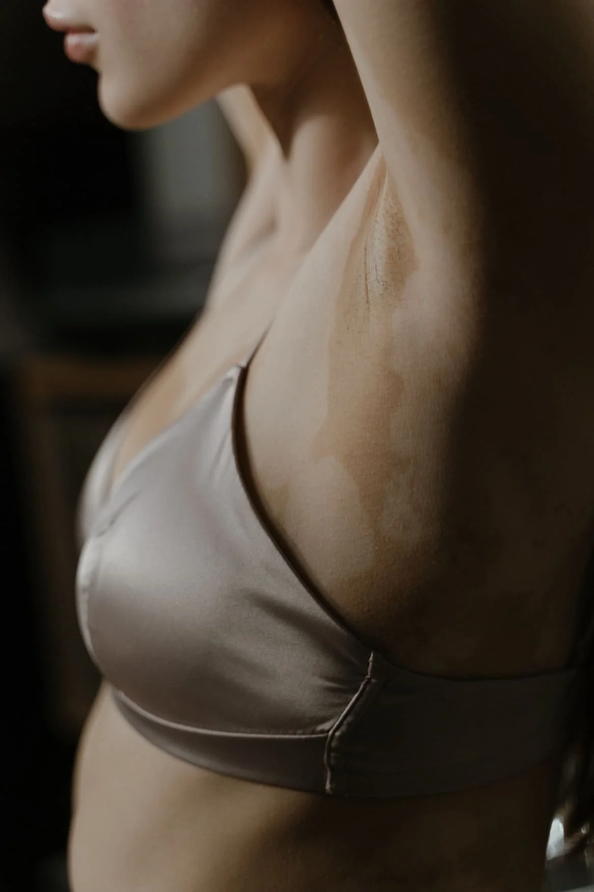 Woman in a satin bra with a soft, natural breast shape, the result of breast implant removal without replacement in Denver at Amavi Aesthetic Surgery